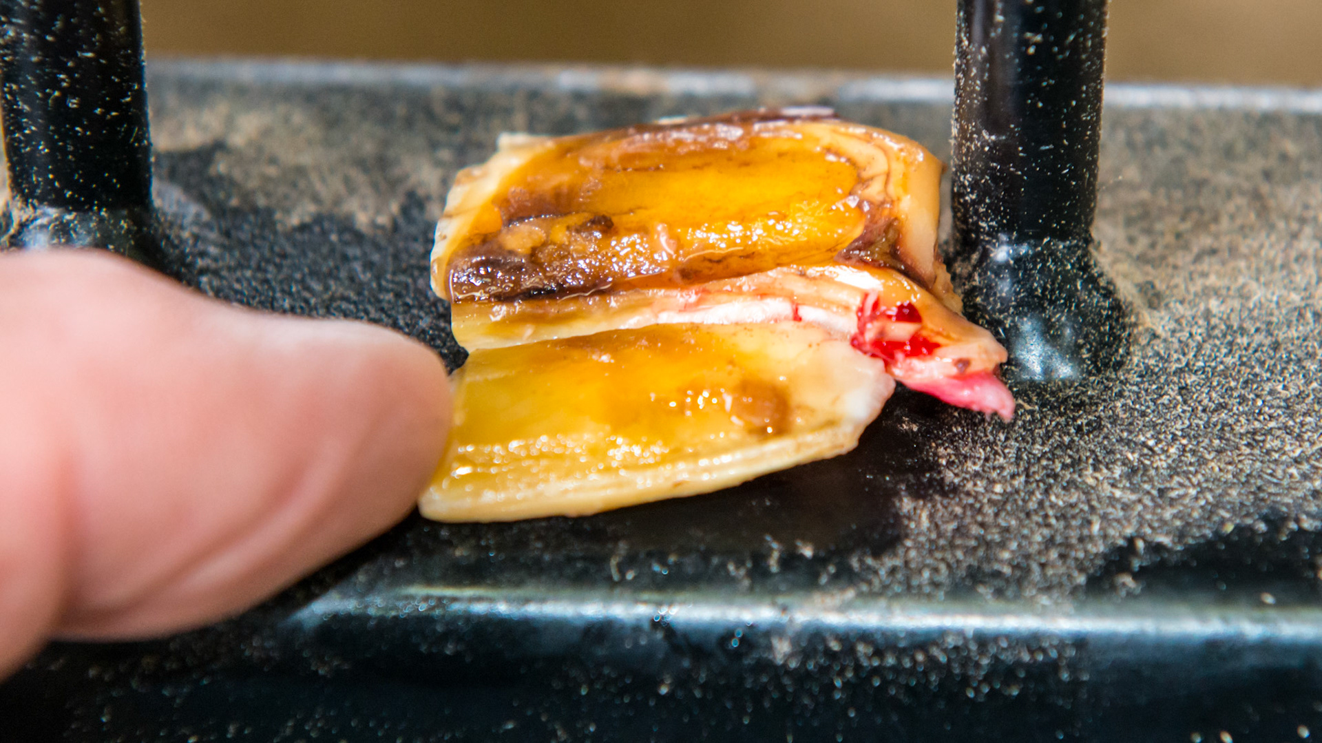 Cheek teeth fracture horse 8 -Extraction of fractured piece from buccal 107 with associated buccal ulcer. The medial edge of the fractured piece with the attached gum. Note the extended piece of tooth beyond the fractured edge.