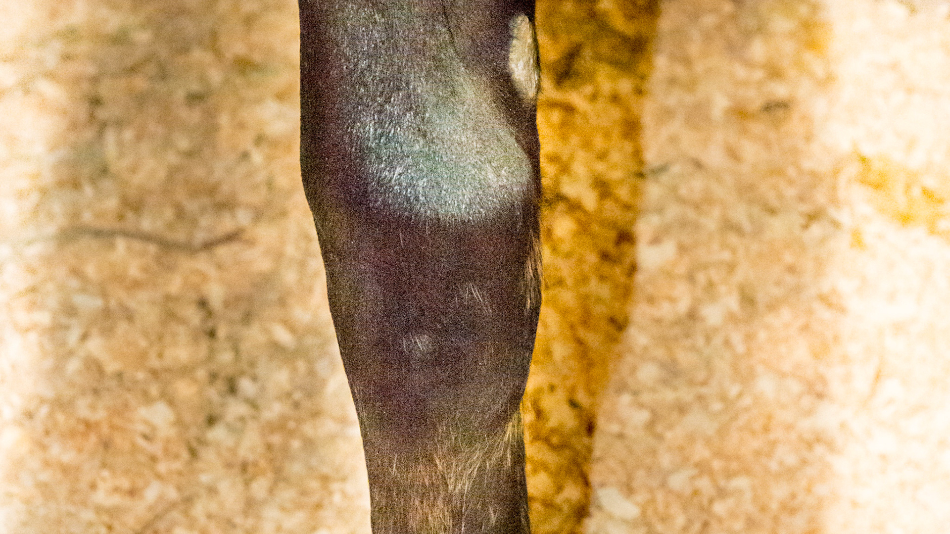 Distal physis (growth plate) of both radius bones (forearm) are enlarged indicating rapid growth from over nutrition.  It is called epiphysitis.
