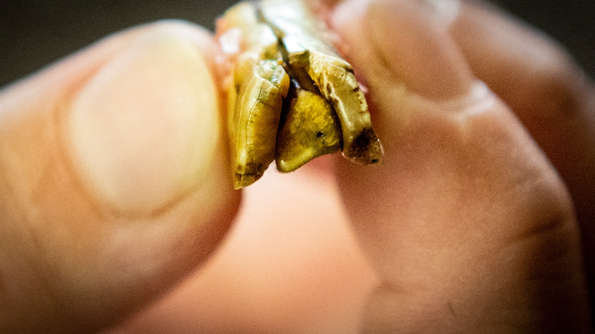 Horse B - Decay in #401 incisor had split this tooth into 3 pieces with the outside pieces broken off of the remaining tooth which remains in the horse. This is the occlusal (chewing) surface