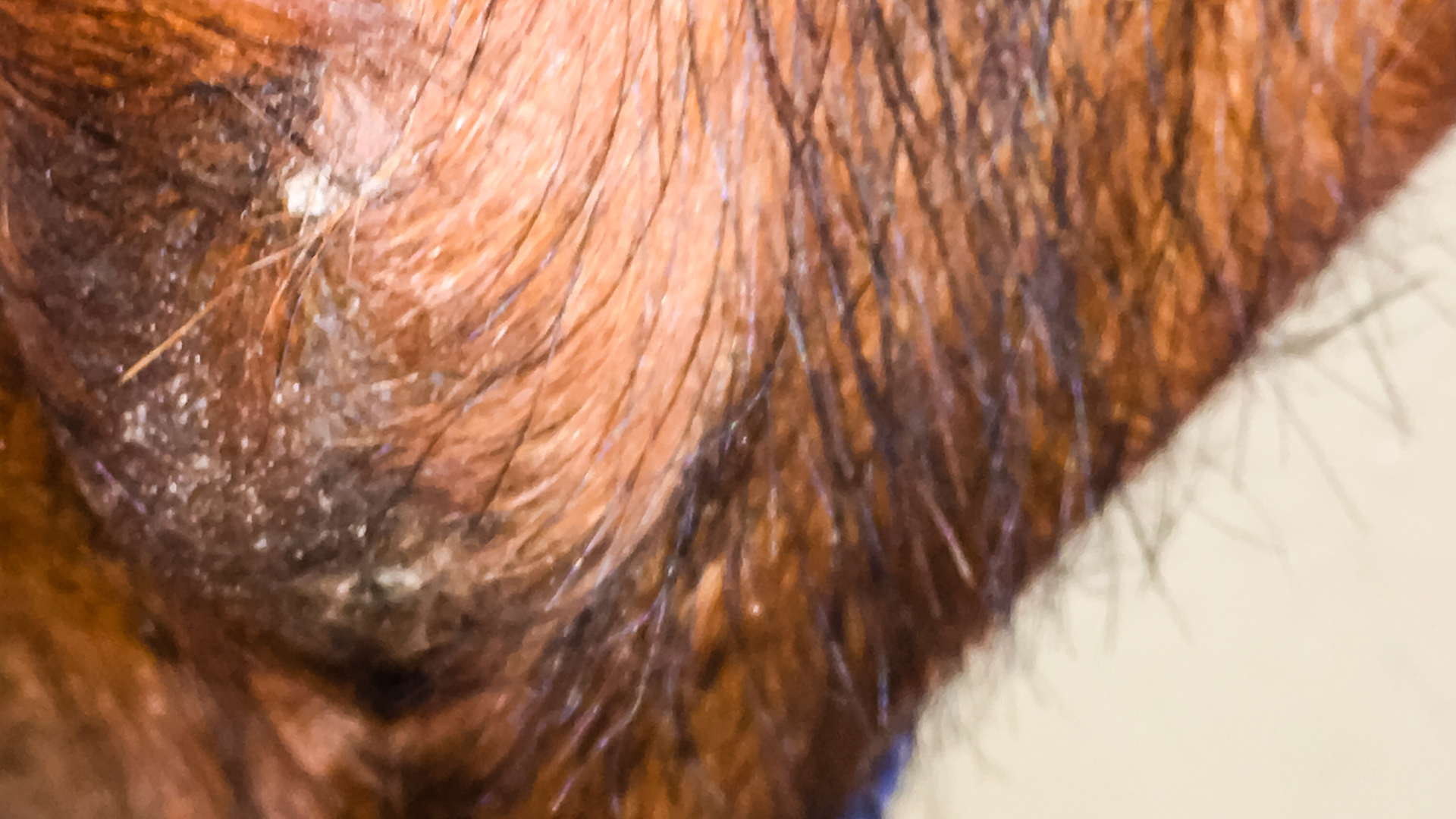 This lump on the ventral mandibula is hard and nonpainful.  The associated tooth (308) was extracted 2 weeks earlier because of chronic draining.  X-rays and a CT scan reveled infection in the roots of 308 and 310.  Long term antibiotics would not resolve this.  Post extraction, the drainage has stopped but the enlargement of the mandibular bone has significantly increased within the mouth while the exterior mass has organized into a taller but less round mass.  Rechecking in another 4 weeks.