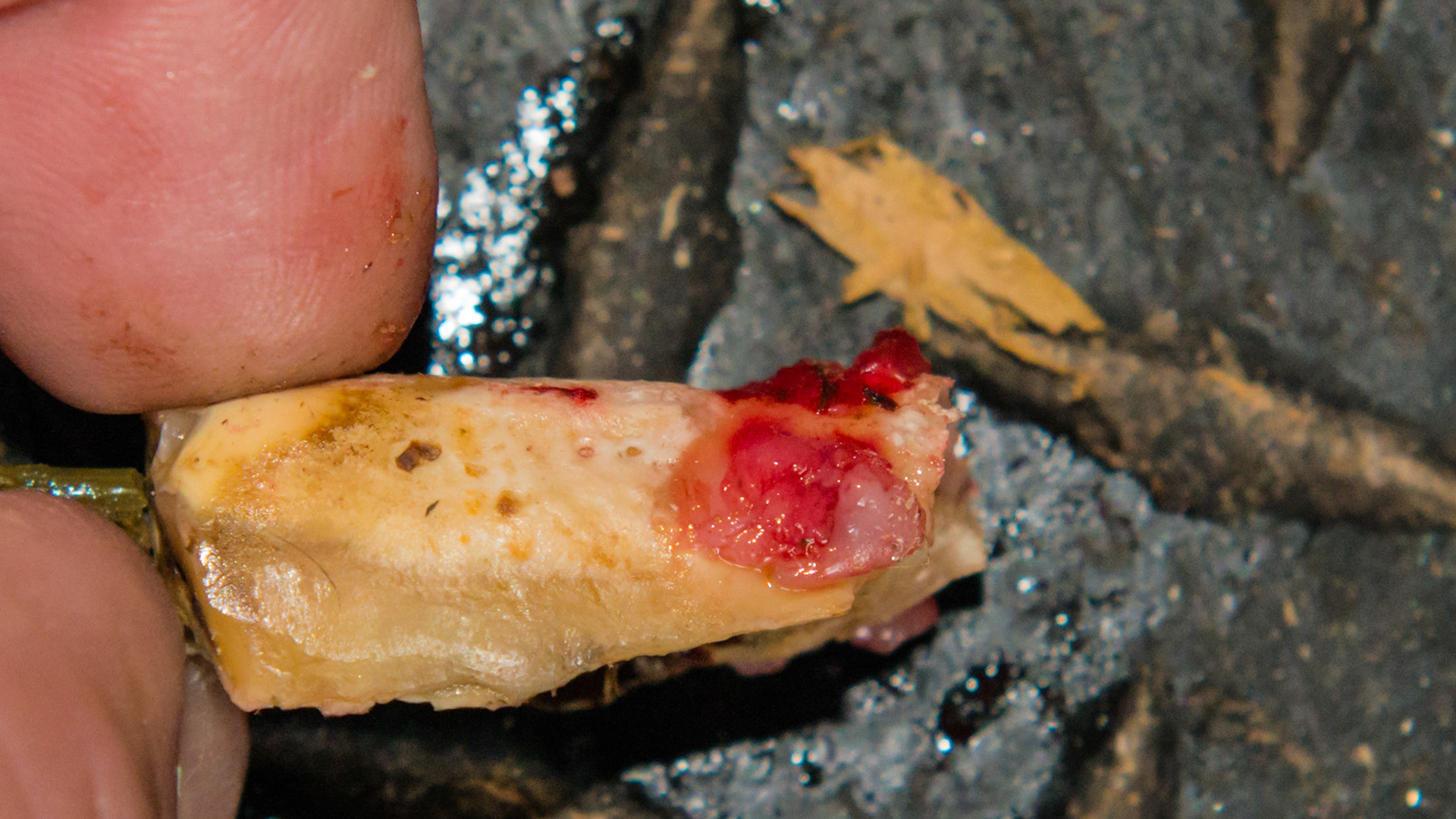 Cheek teeth fracture horse 7 -Fractured #109 and 209 in a rescued mini horse.  These are the extracted palatal pieces. Both teeth were tilted towards the cheek. Note the curved reserved crown of one of the fractured pieces.
