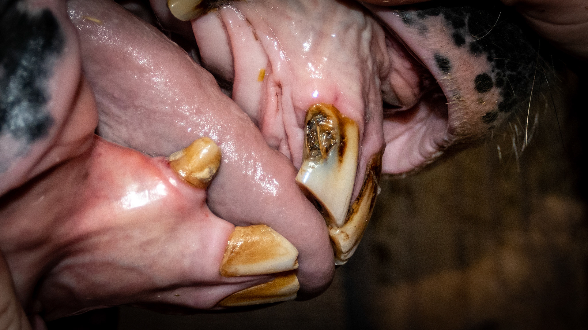 Decay #103 in a 19 year old. The decay has been there for "years"