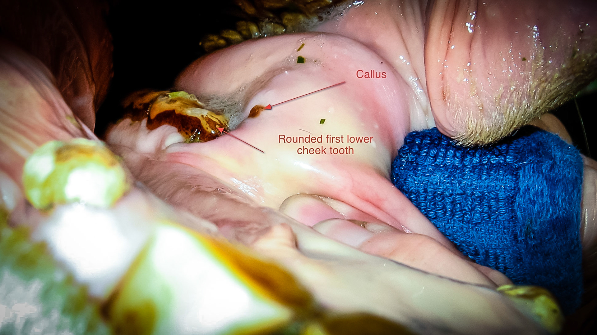 Flabby cheeks is a name I created for the excessive fat tissue laying on the bars in front of the 1st lower cheek teeth.  This tissue becomes caught between the bit and the sharp rostral point of the 1st lower cheek teeth.  Some horses don’t mind this while others become unridable with a bit.
