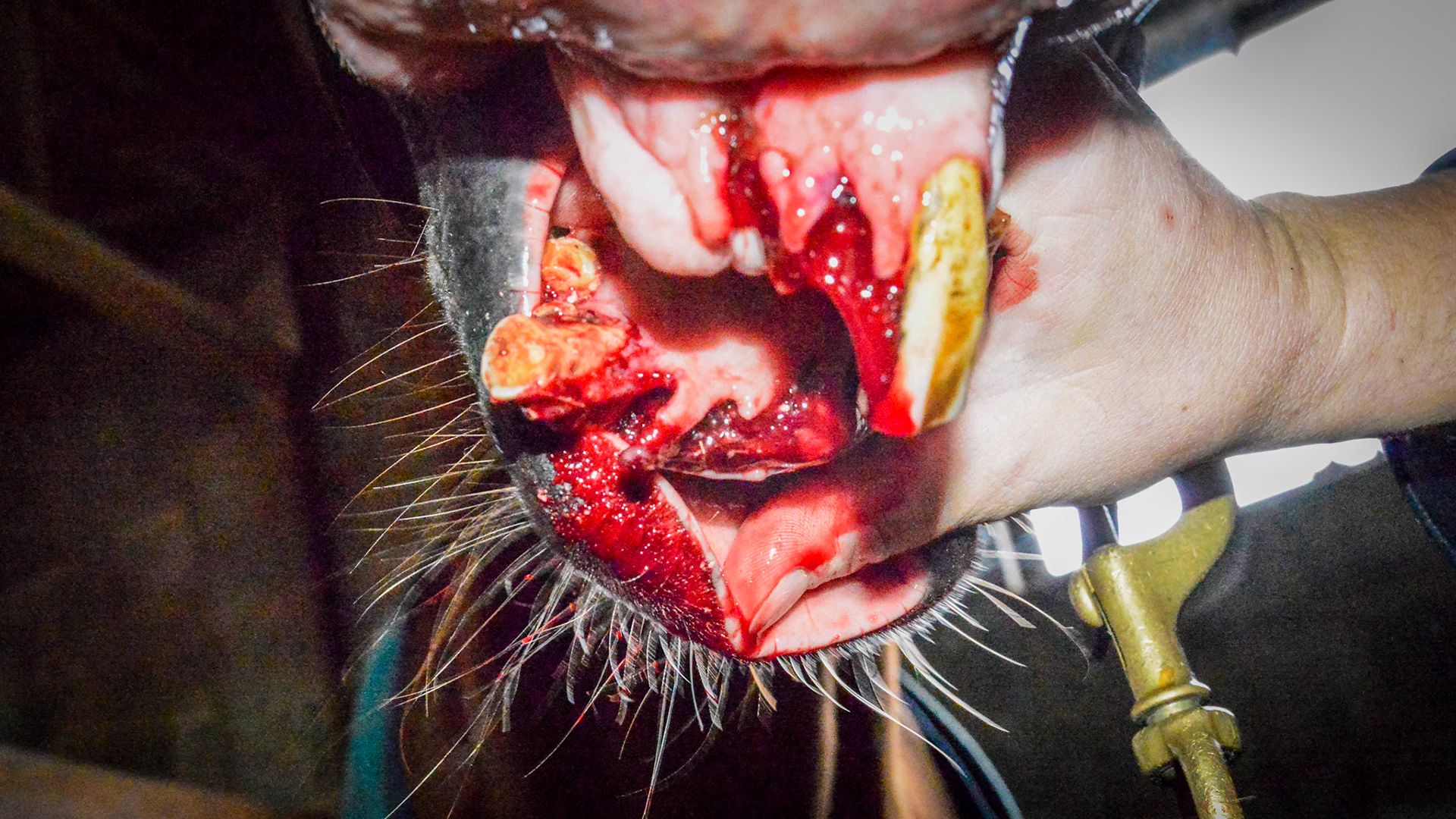 ETORH horse 5 - with loose, painful, &amp; necrotic incisors. Excessive tartar due to tongue not moving over the painful teeth. Extracted with IV sedation and analgesics. Horse went right to eating without difficulties afterwards.