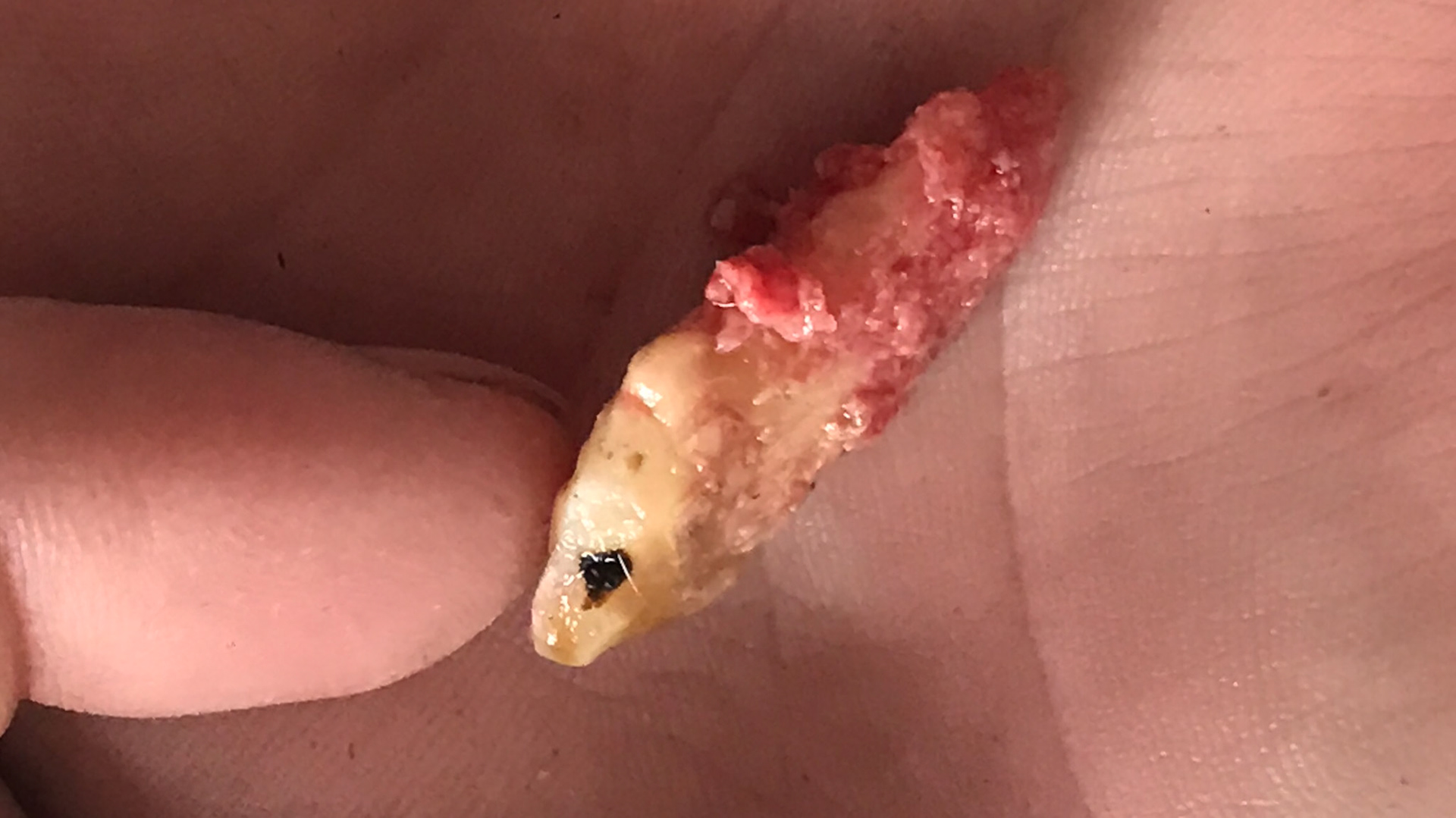 ⅔'s of this wolf tooth was below the gum line as seen from the attached pink tissue.