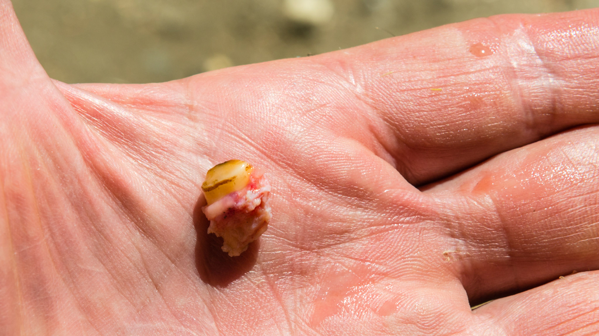 Wolf teeth 105 and 205 set towards the inside of the 6's in a 3 yr old Mustang. Difficult to start. Needed to keep mouth open with one hand and insert the elevator from the inside of the mouth and angled from medial to lateral to catch the edge. Then they came out with just a little struggle. Lingual edge.