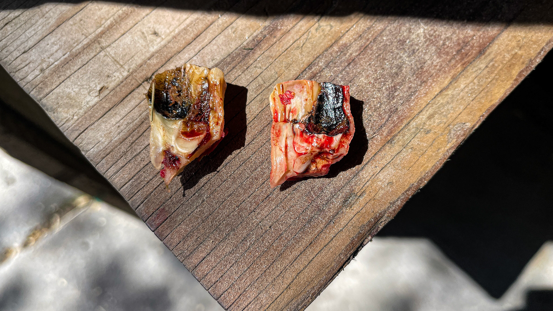 Two palatal saggital fractures in a pony. One from 109 and the other from 209. 6 months earlier I removed another similar fracture from 108.