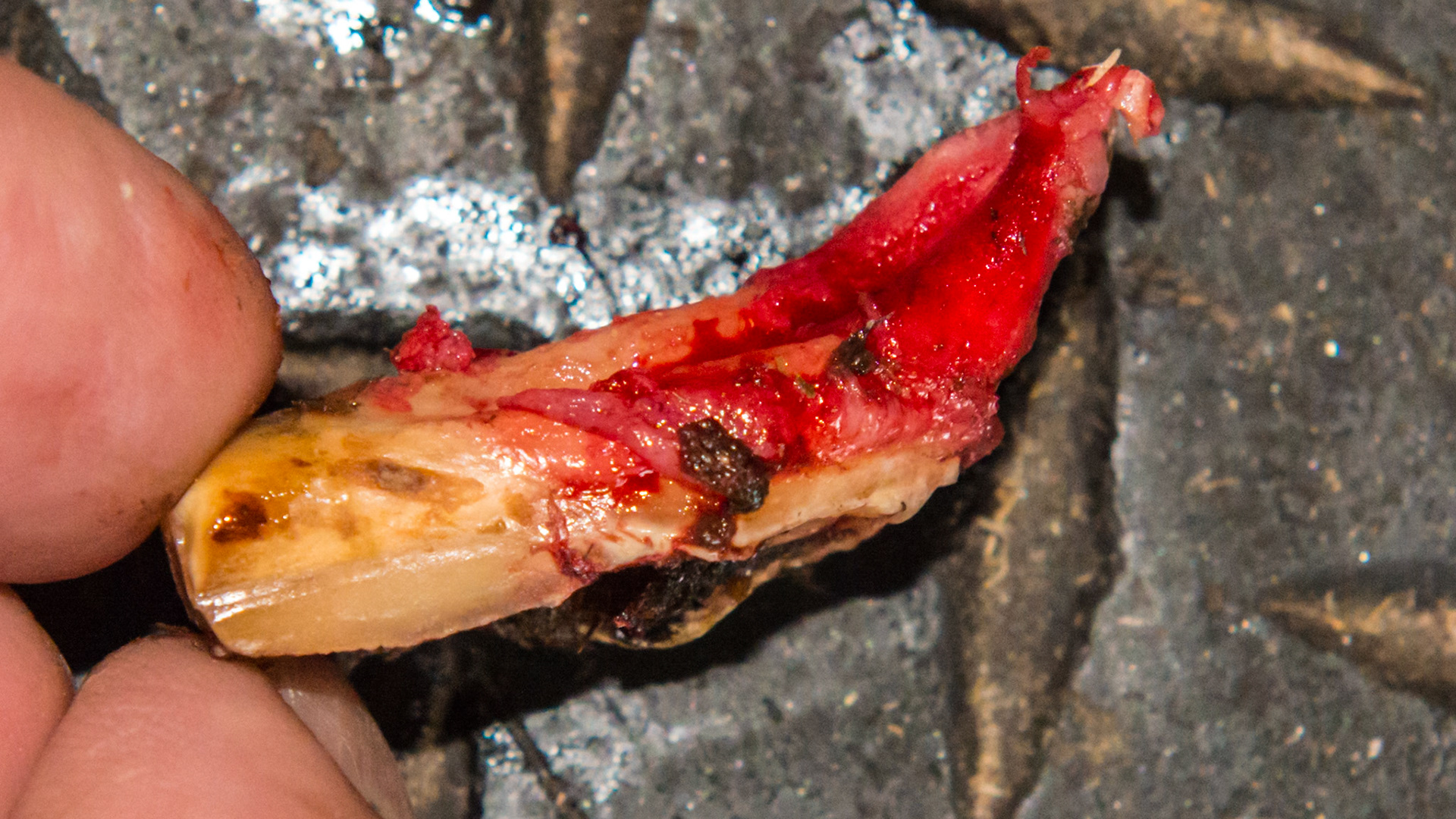 Cheek teeth fracture horse 7 -Fractured #109 and 209 in a rescued mini horse.  These are the extracted palatal pieces. Both teeth were tilted towards the cheek. Note the curved reserved crown of one of the fractured pieces.