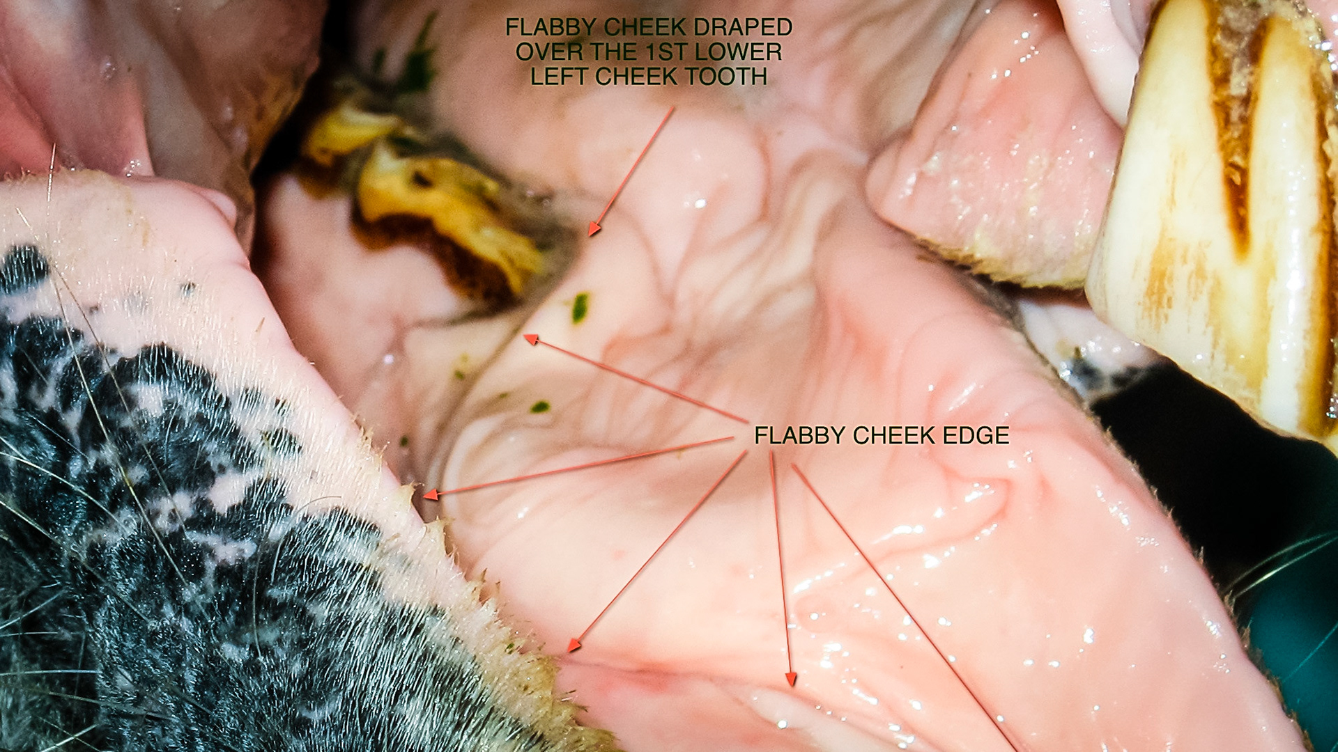 Flabby cheeks is a name I created for the excessive fat tissue laying on the bars in front of the 1st lower cheek teeth.  This tissue becomes caught between the bit and the sharp rostral point of the 1st lower cheek teeth.  Some horses don’t mind this while others become unridable with a bit.