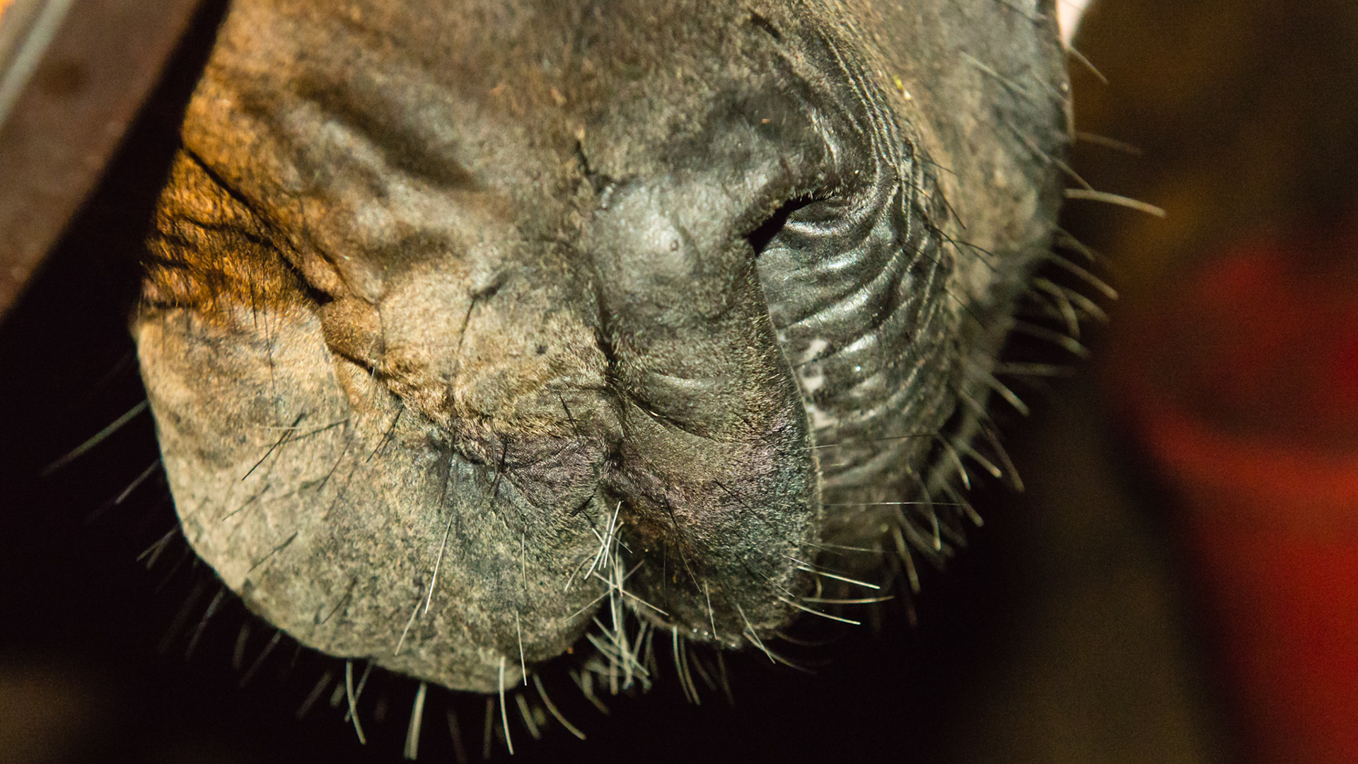 18 yr old with old trauma - missing 101, broken 102, and lip neuro deficit and #402 slightly overerupted whit tounge ware on front edge.