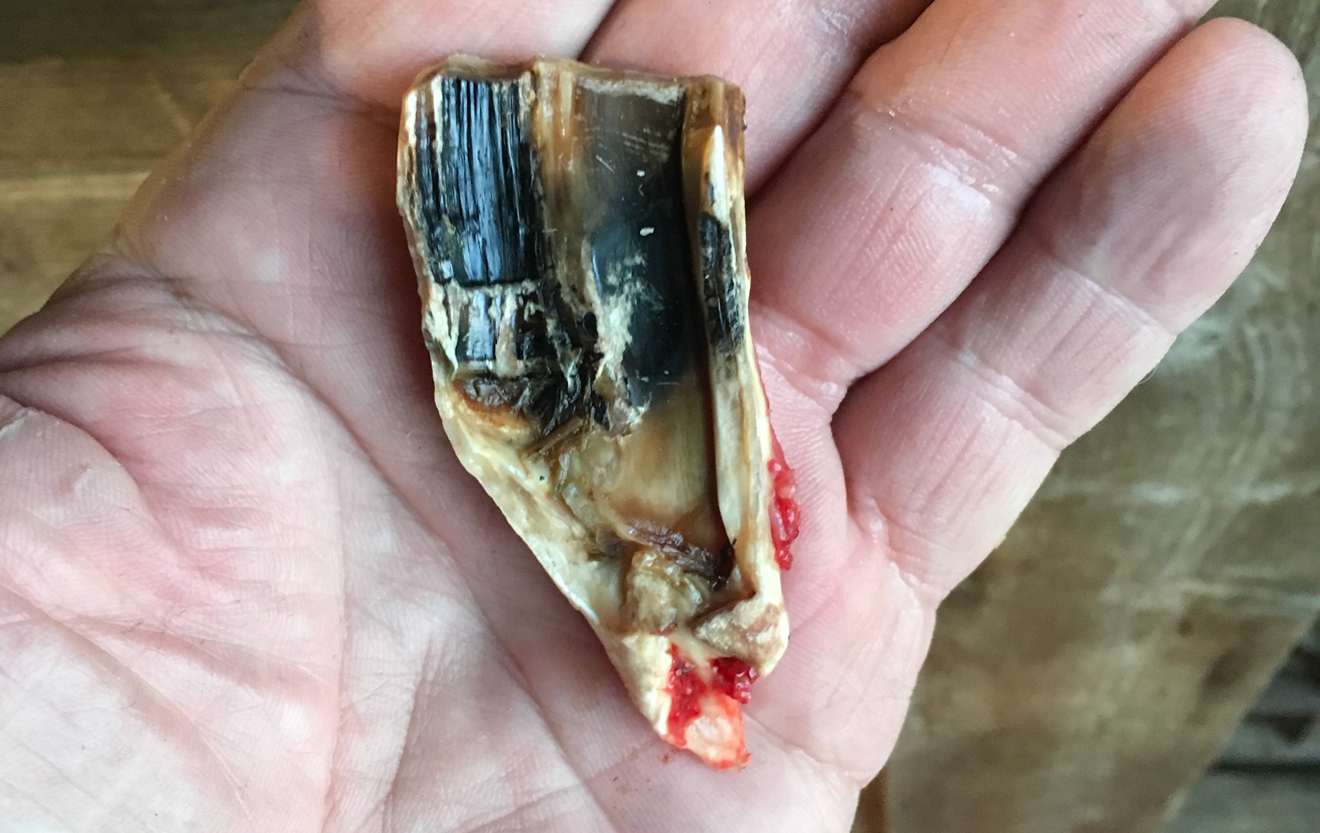 Large cheek tooth fracture shows the black decay that caused the saggital split.