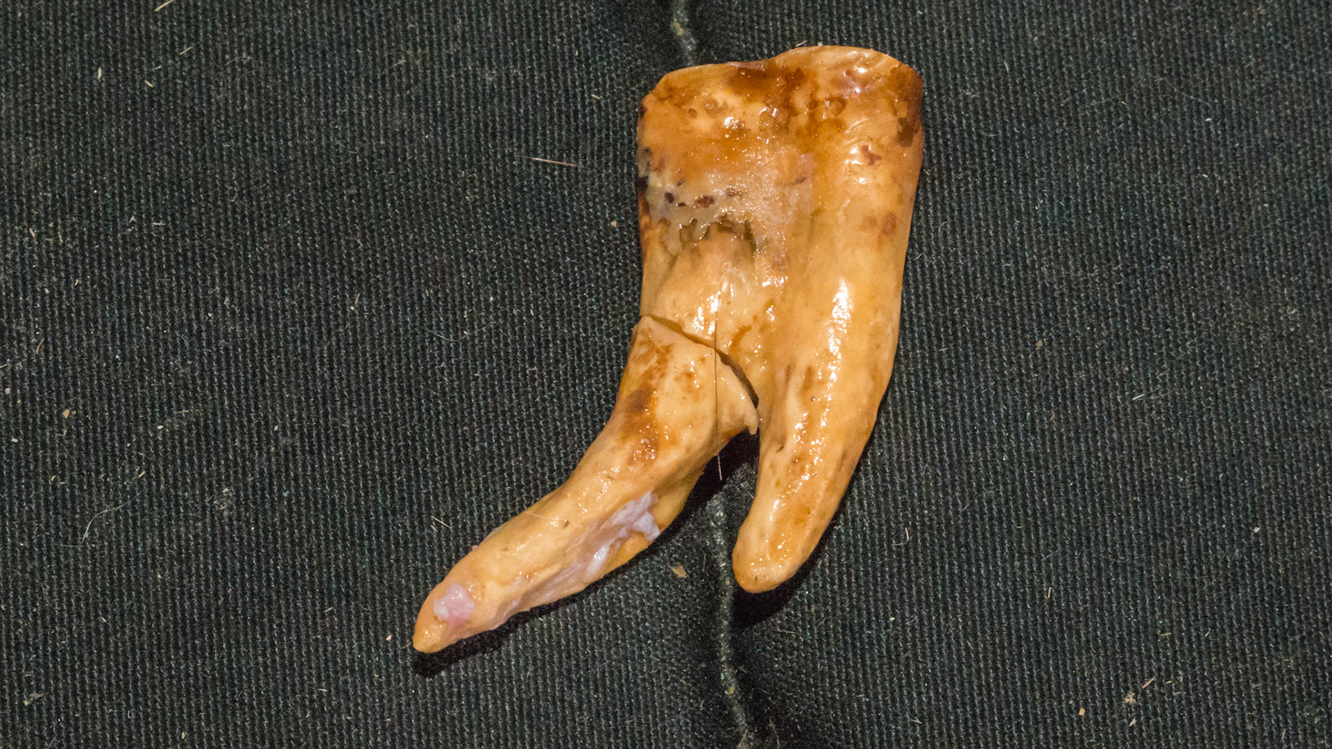 Cheek teeth fracture horse 4 -Extracted fractured 410 buccal with lingual piece missing. Lateral view with root that was broken during extraction and removed separately.