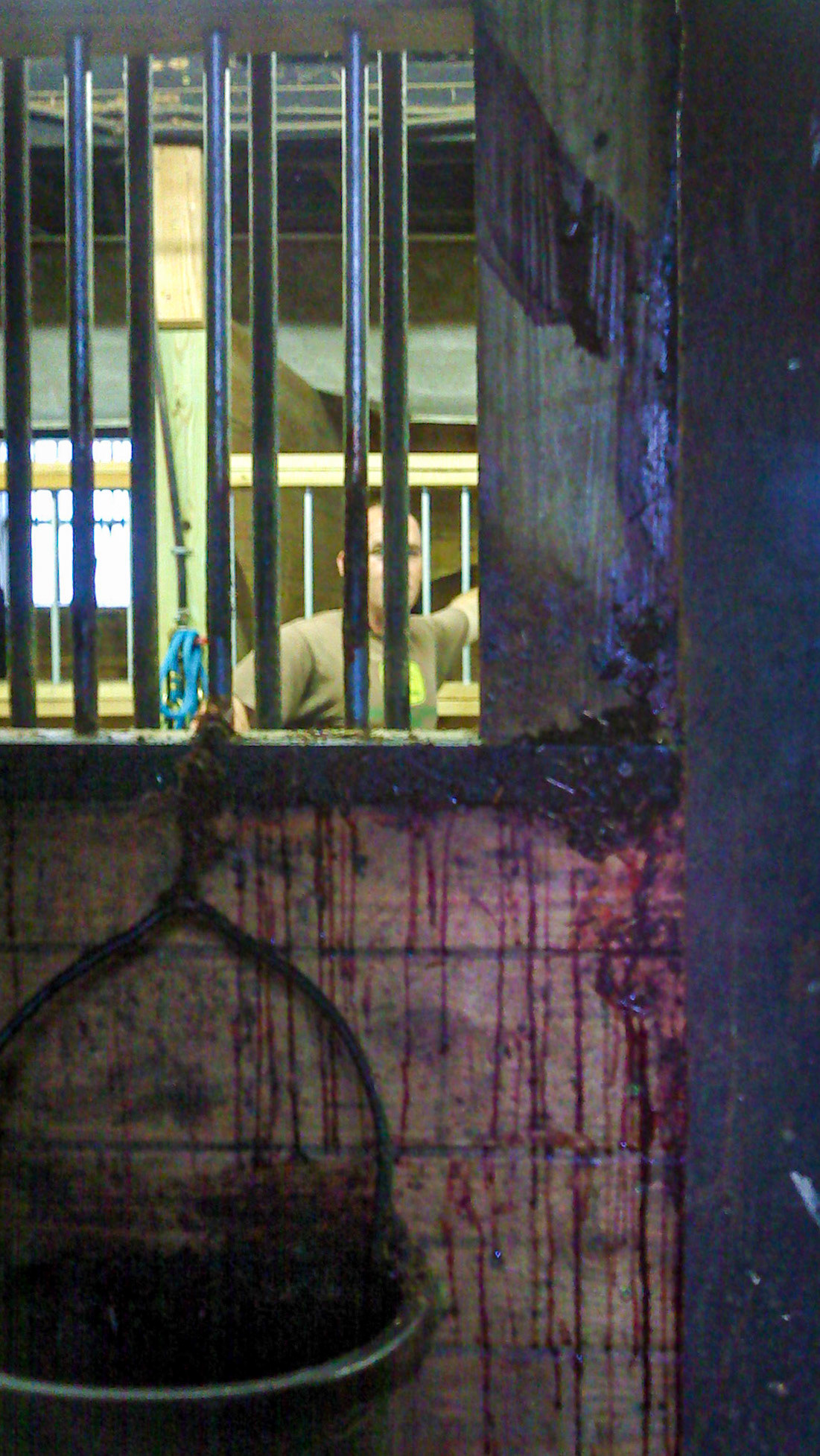 Nose bleed from trauma from a blunt object accidentally entering the nostril rather than the mouth.