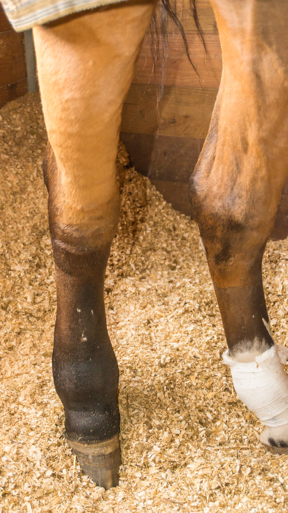 Lymphangitis is inflammation of the lymph system that flows throughout the body. When blocked, the tissue becomes swollen and susceptible to infection. It is unlike stocking up because 1) it is usually in one limb, 2) there is usually more heat, 3) it is painful, 4) it is not pitting (you can’t leave a finger indentation. Lymphangitis is a serious medical condition.