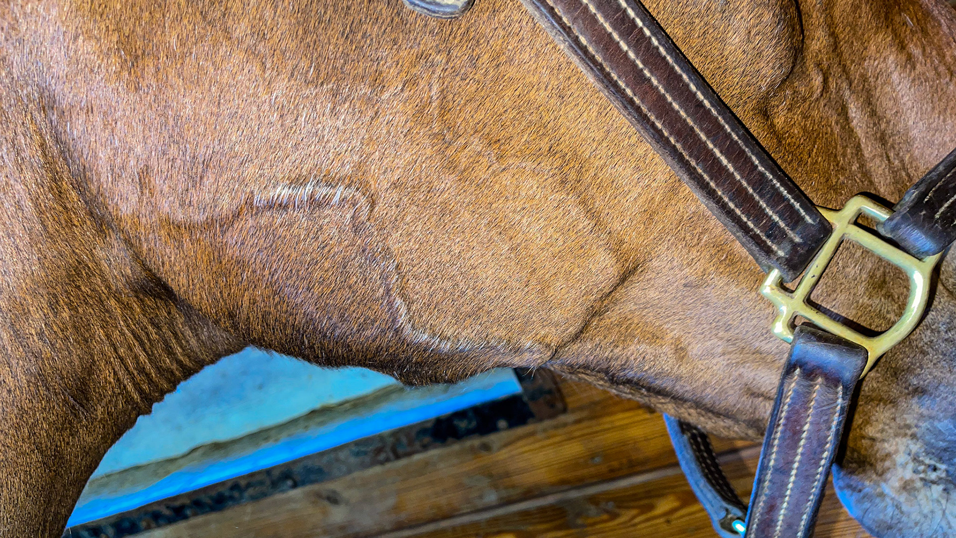 Thrombosed veins on the side of the head with overlying gray hairs. Unknown cause but trauma suspected.