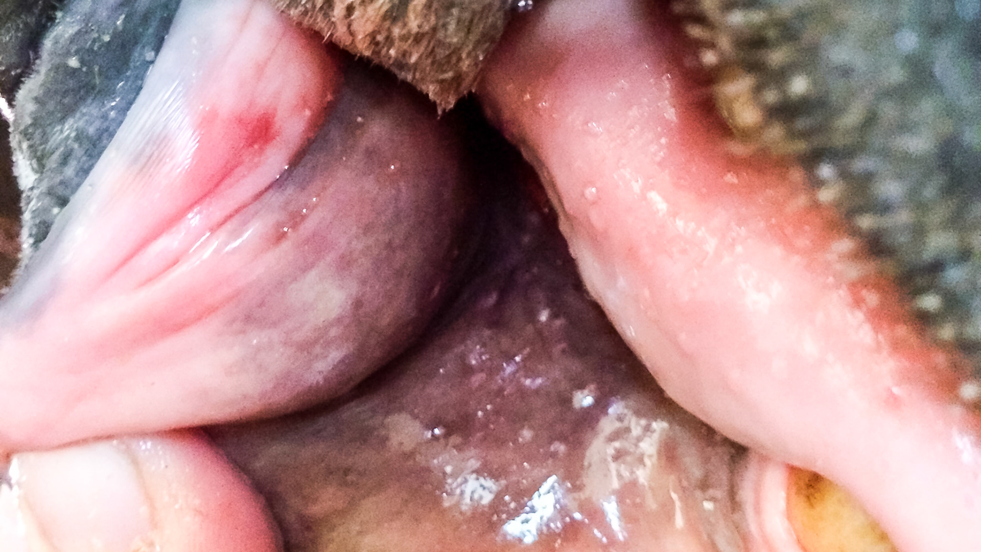 Bruising and cuts of the edge of the lip.