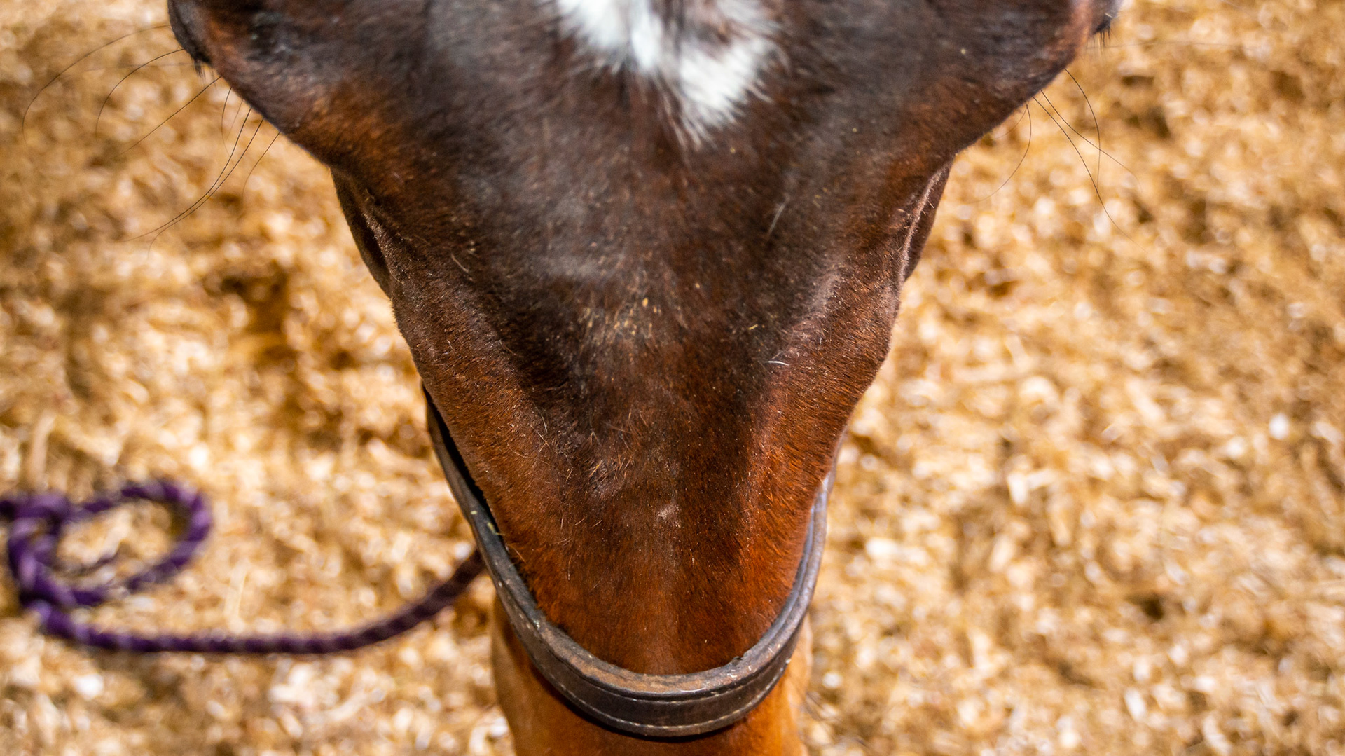 Maxillary eruption lumps