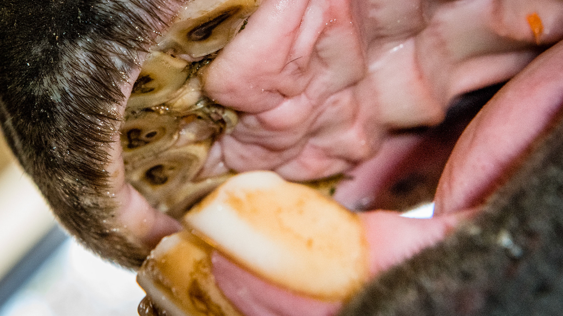 72 and 82 cap remnants in a 17 year old. Malodor but not painful. Removed without drugs using a wolf tooth elevator.