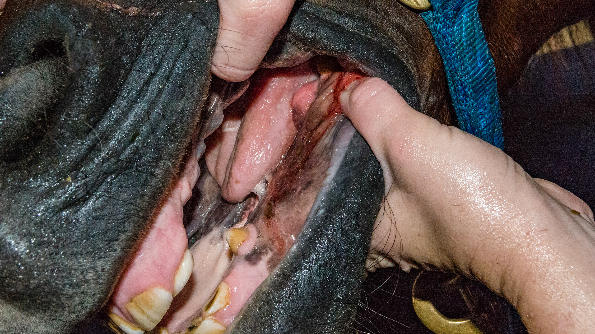 Soft tissue mass on the mandibular gum line