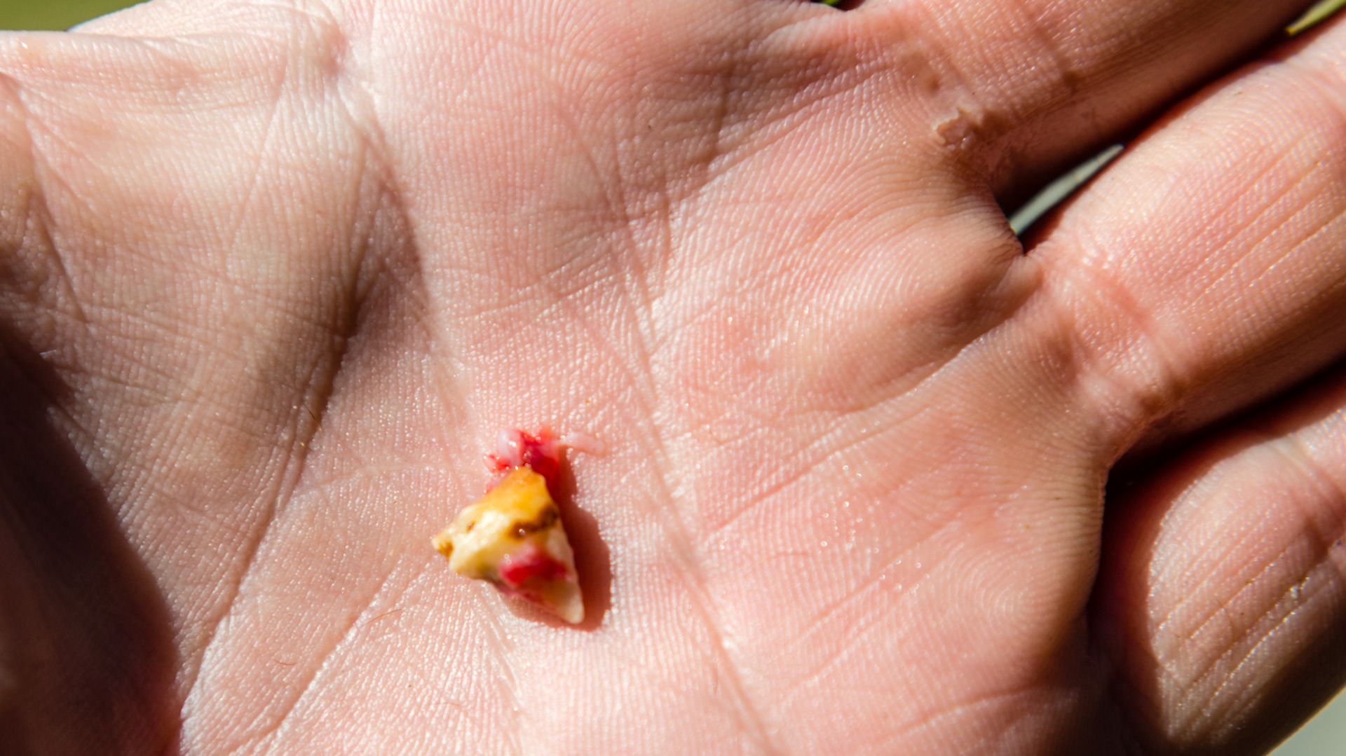 This cap remnant was found firmly attached to the of 408 lingual gum line of a 6 year old warmblood.  No drugs were needed because this horse had no pain associated with the extraction. The parallel dental pick was used to lever it out.