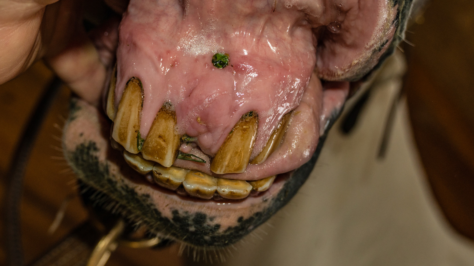 Incisor extracted about 6 months ago