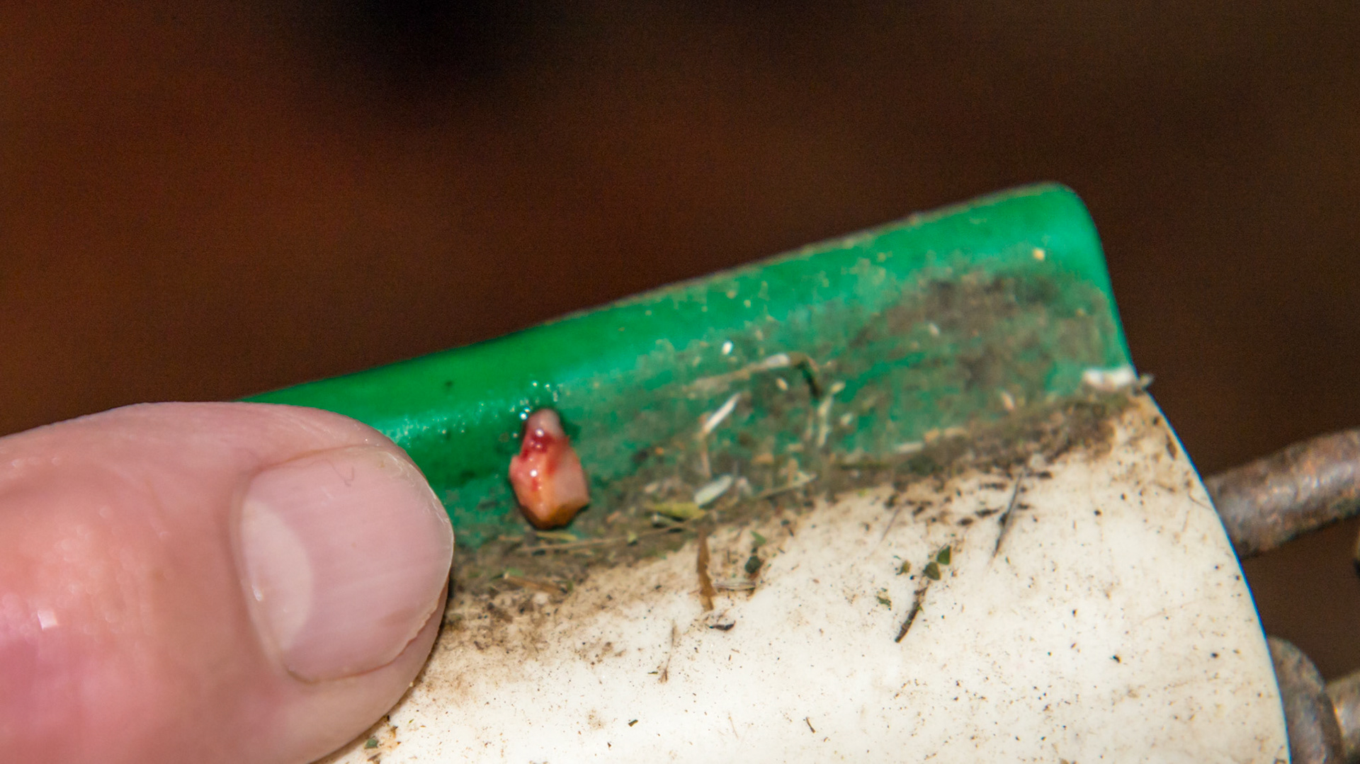 A small cap remnant located on the lingual side of 308.  It was painful to touch indicating a local infection, but there was no smell.