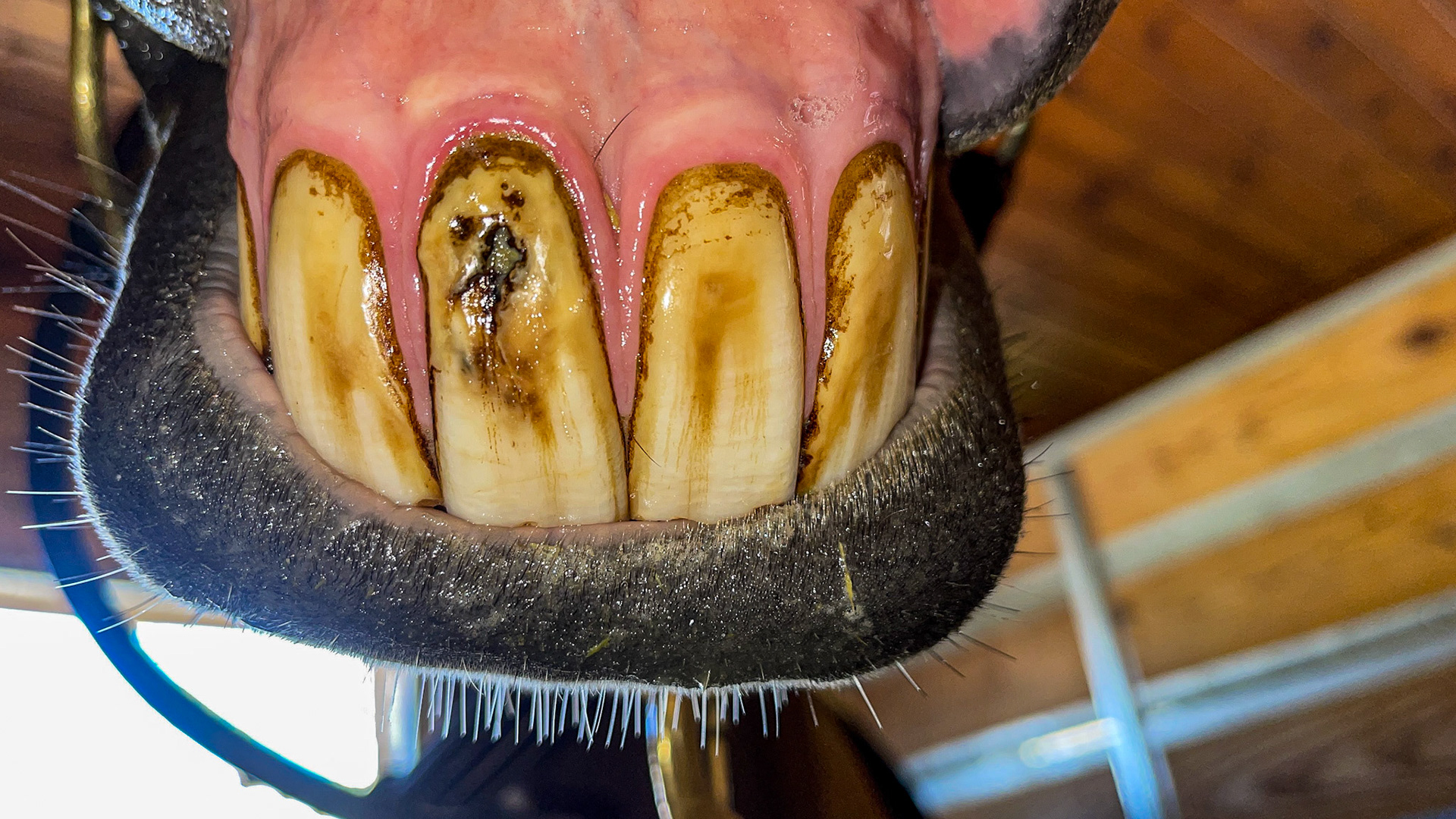 EOTRH with abscess in 101