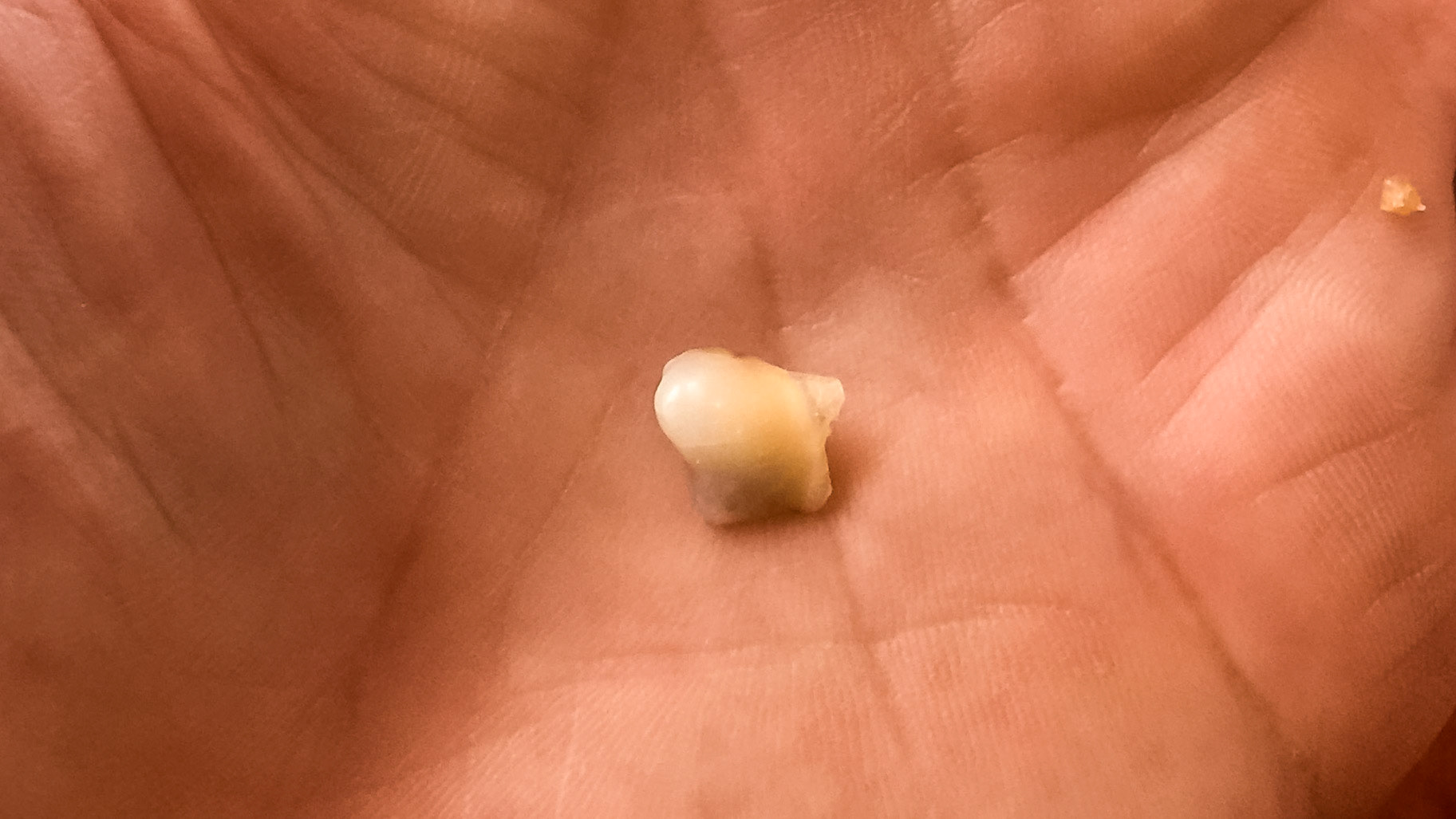 Cheek teeth cap remnants.