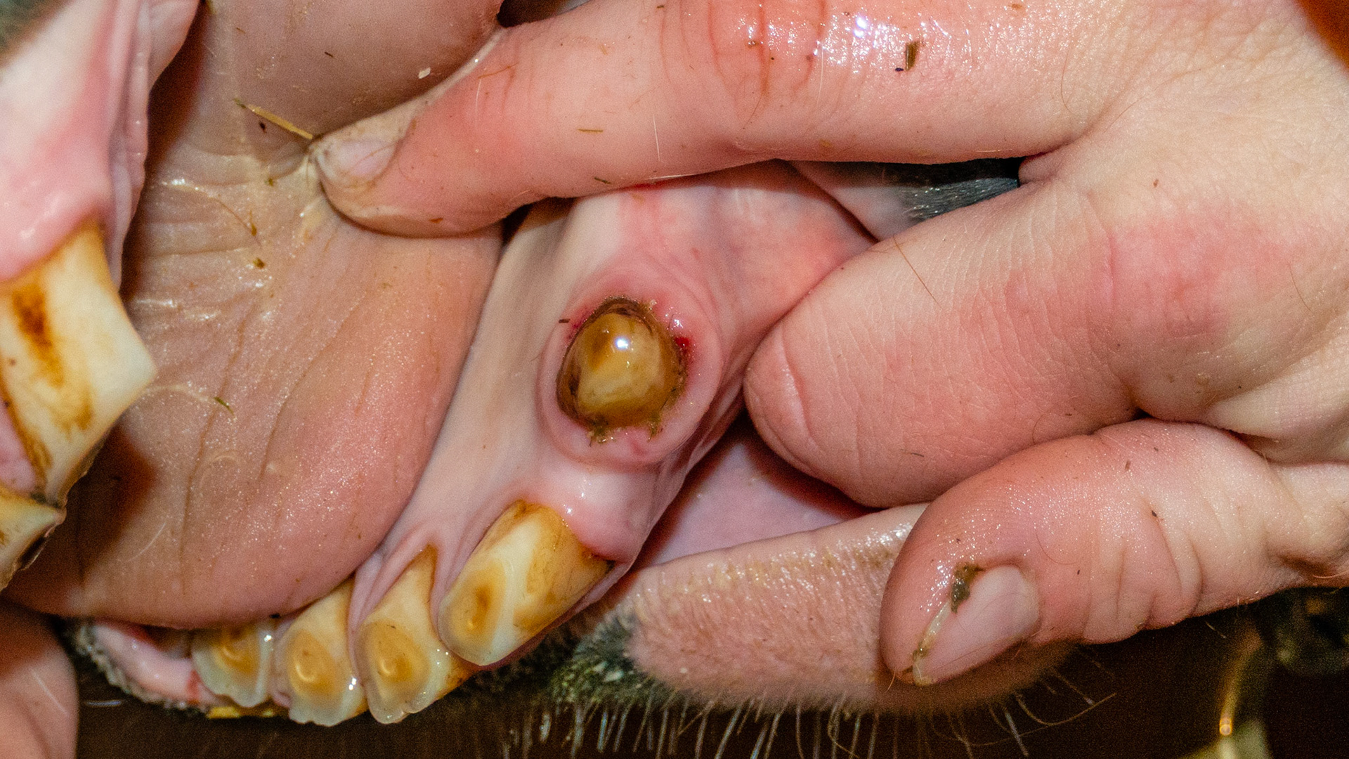 Hyperplasia of gums surrounding incisors and canines that is a precursor to EOTRH.