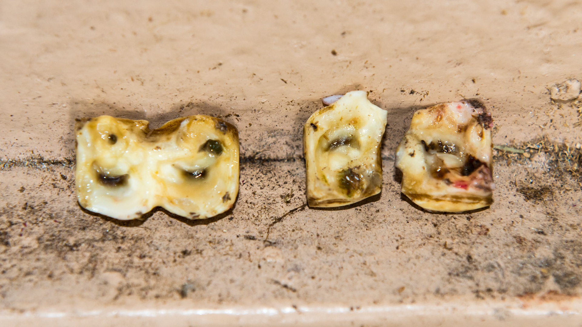 These are the #77 and 87 caps showing in one the occlusal surfaces and in the other,  the underlying surface with the green feed indicating the maturity of these caps.  #77 was split and was extracted in 2 pieces.  #87 has a fissure starting and would have cracked in two if left in the mouth.