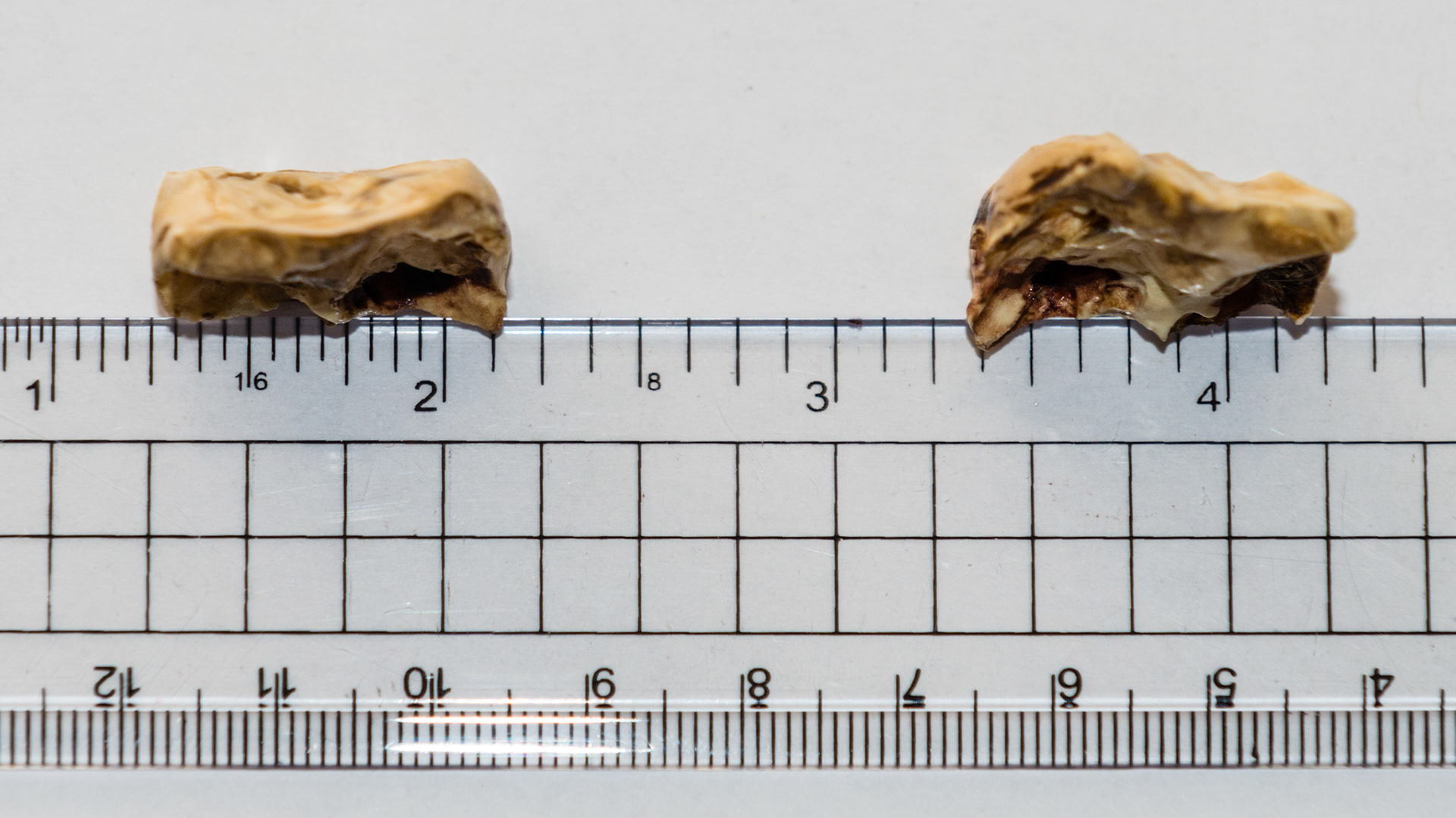 These are examples of broken cheek teeth caps. The broken edge can be very sharp causing discomfort in these horses.