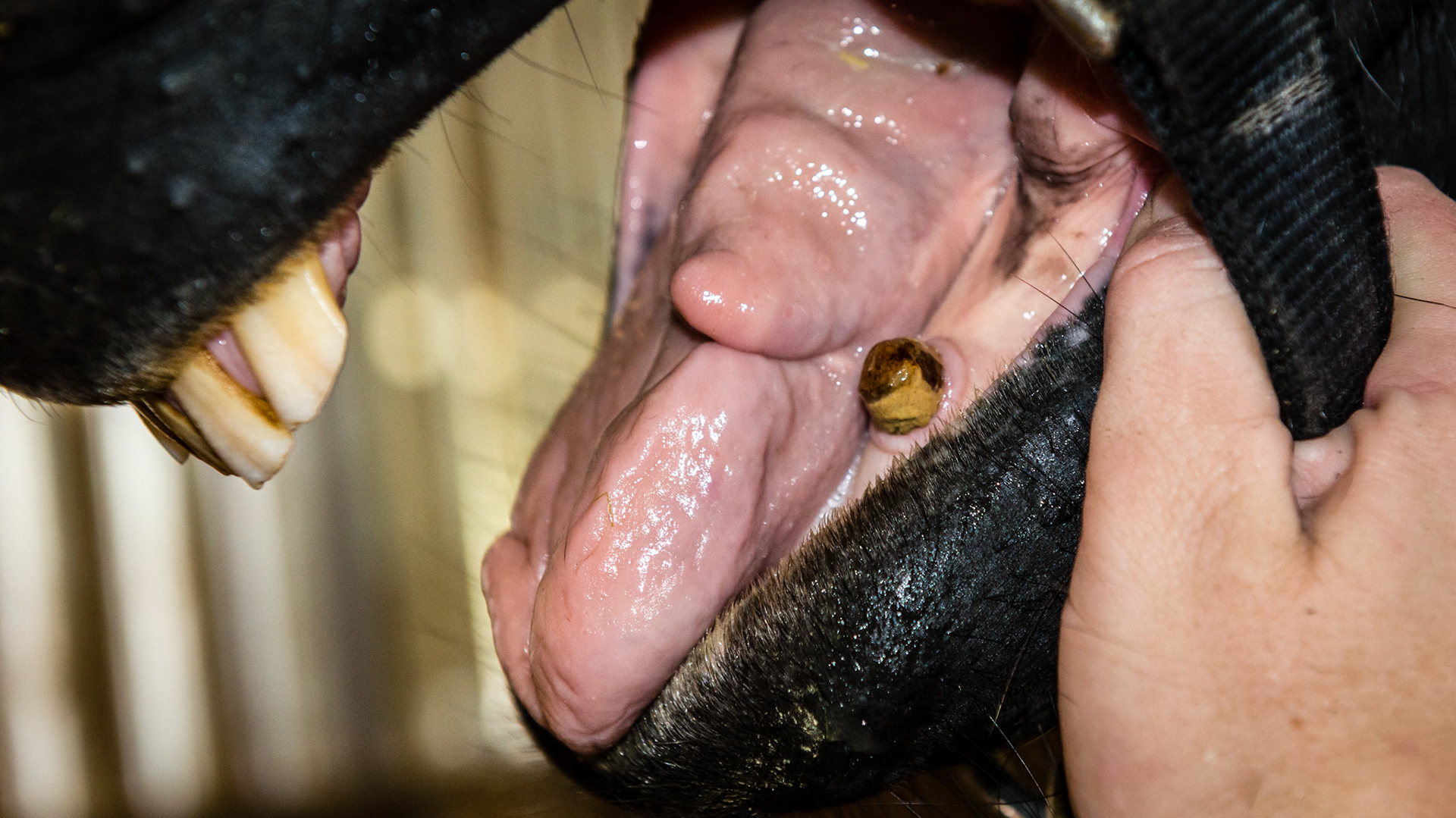 An old tongue wound as an incidental finding