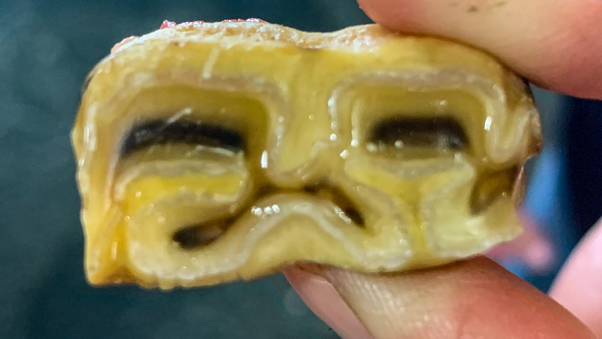 The occlusal surface of a deciduous cheek tooth (cap) showing the pulp chambers - or a frown face :-(