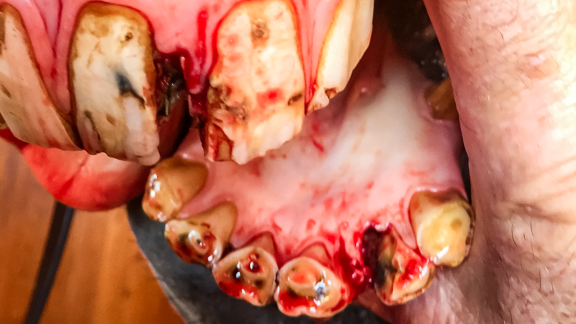 Incisor fracture horse - The upper 202 and the lower 302 incisors are both fractured in this horse. Cause is unknown but trauma is suspected. This series shows the before and after removal of the dead pieces of tooth with various views of the extracted pieces.