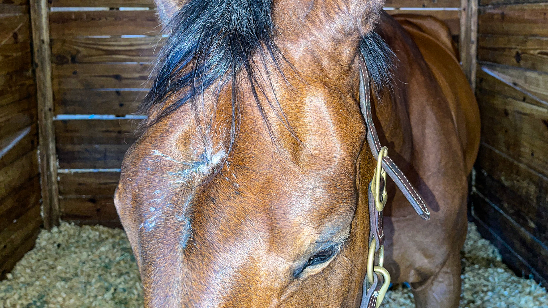 A sunken face from trauma to the skull. This area covers the sinuses but not the brain, which is further up the face and is not affected.