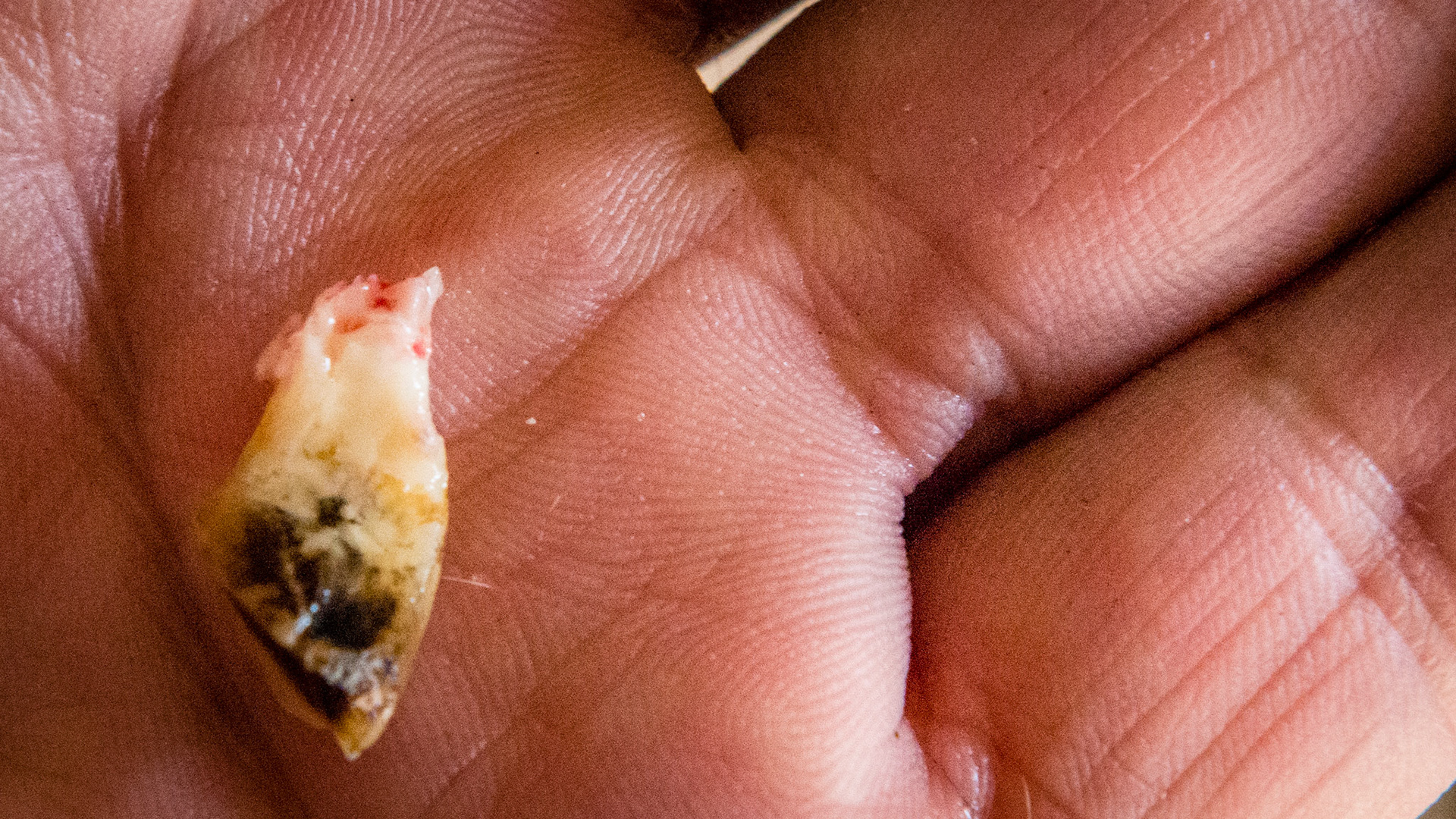 Incisor cap extractions horse 6 - The extracted cap.