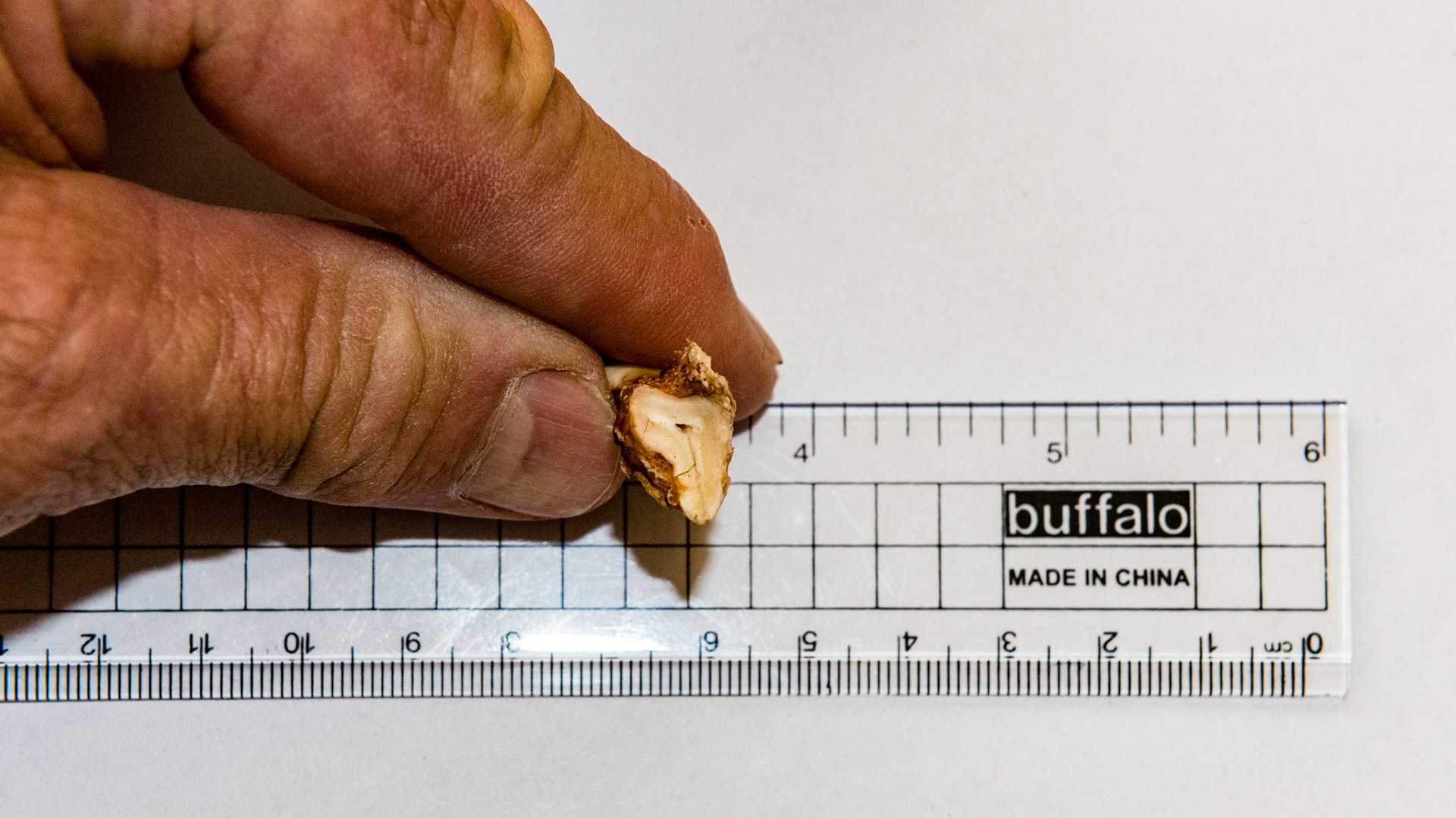 These incisor caps have excessive roots that look more like alveolar bone. Caps like these often remain attached displacing the underlying permanent incisor and requiring extraction by the dentist.