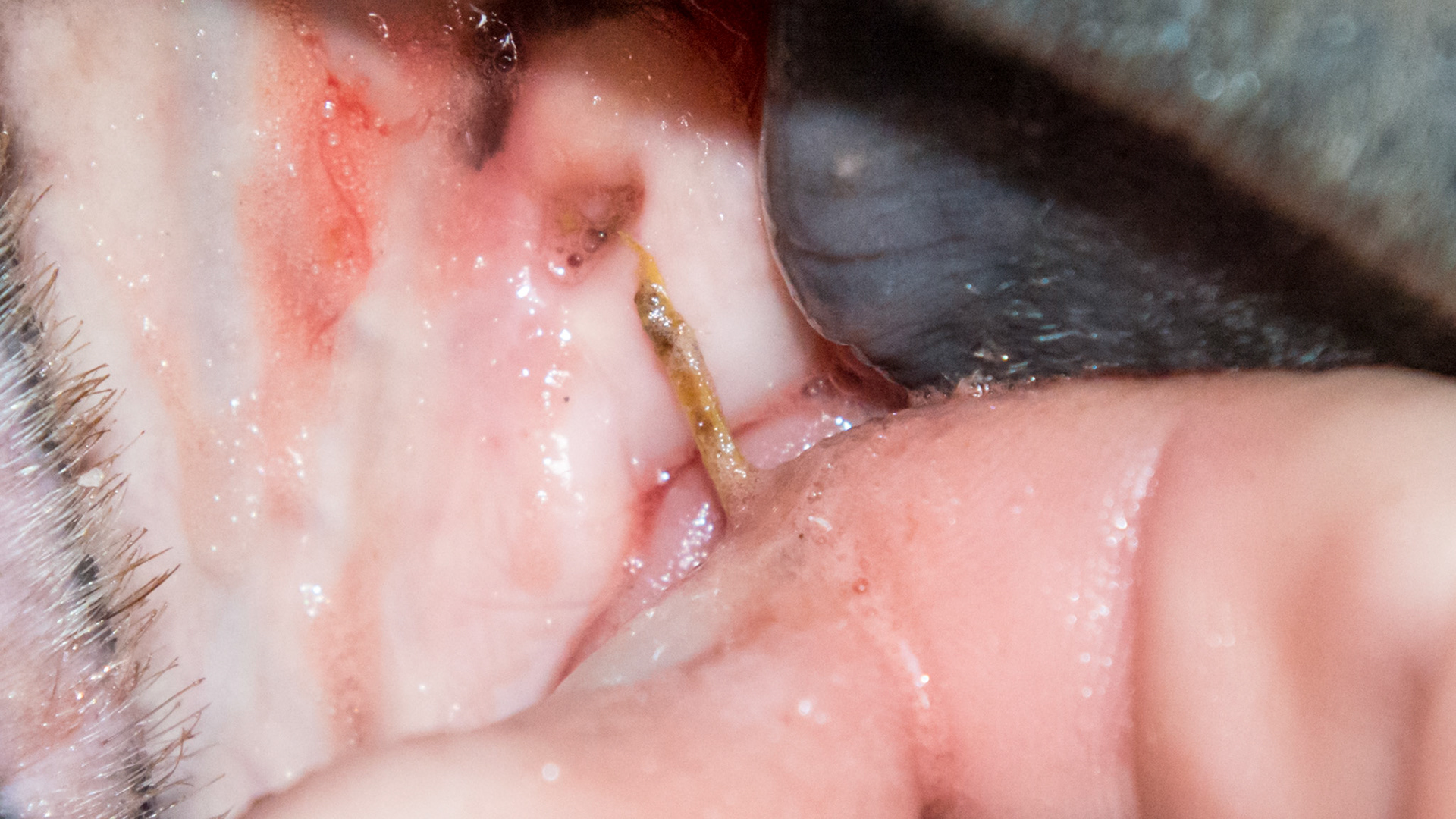 Hole - Small hole in gum above #205 where a foreign object was palpated.  It was non-painful. Here the fingers were able to extract this piece of hay from the hole.