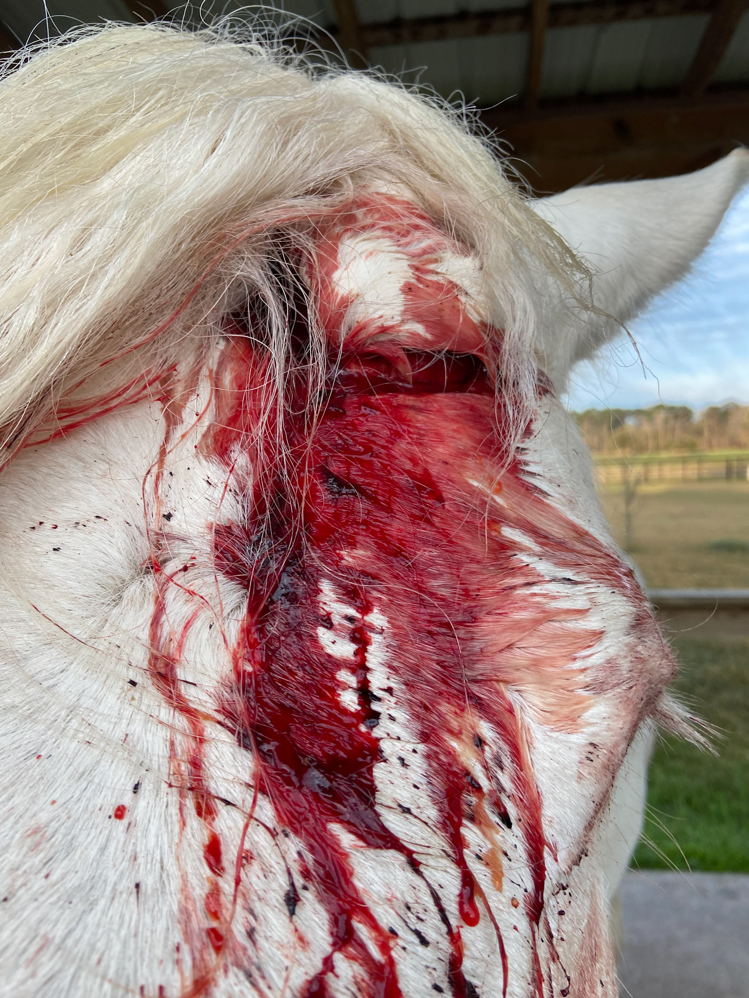 A head laceration before a drain and sutures were placed.