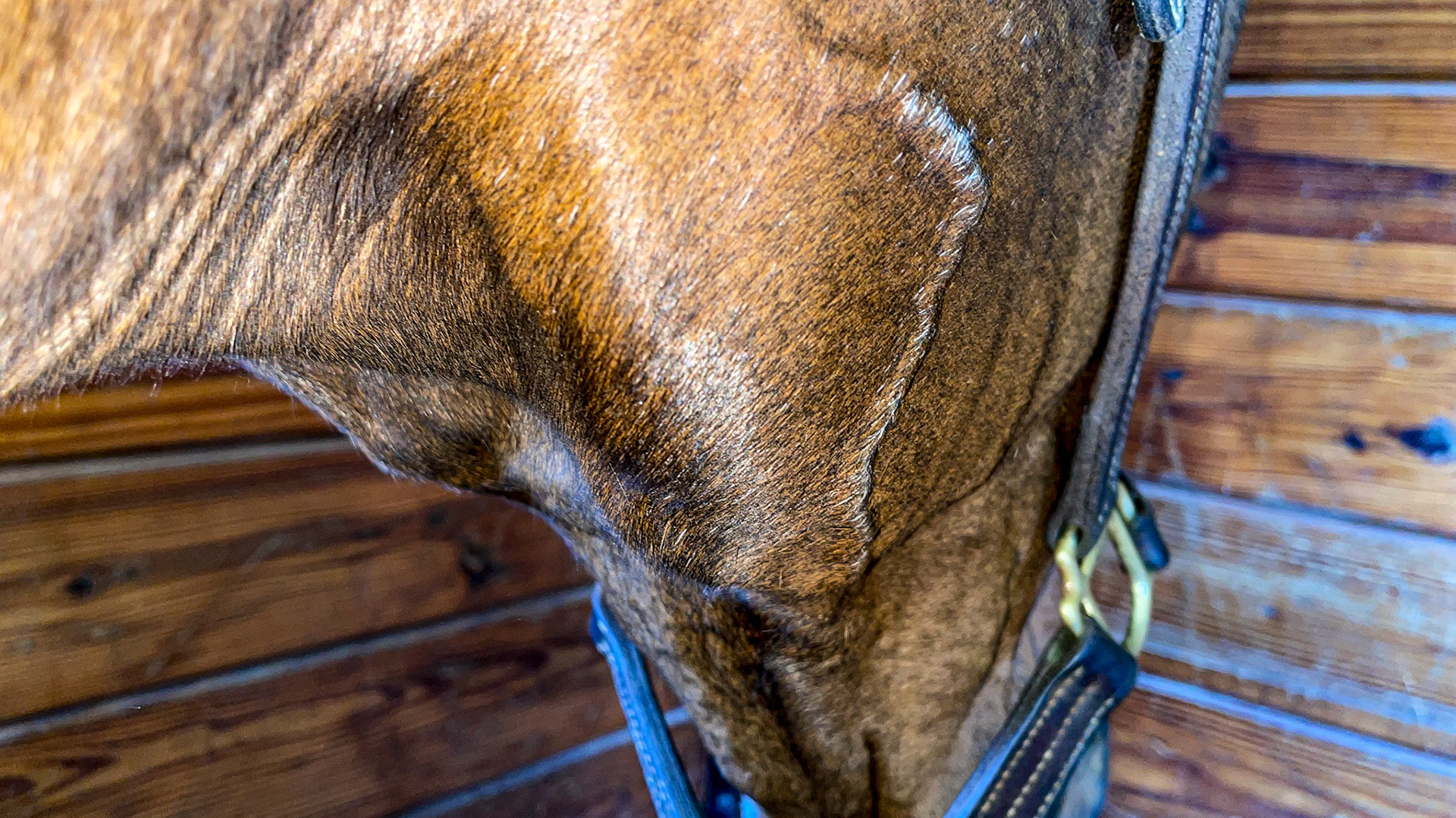 Thrombosed veins on the side of the head with overlying gray hairs. Unknown cause but trauma suspected.