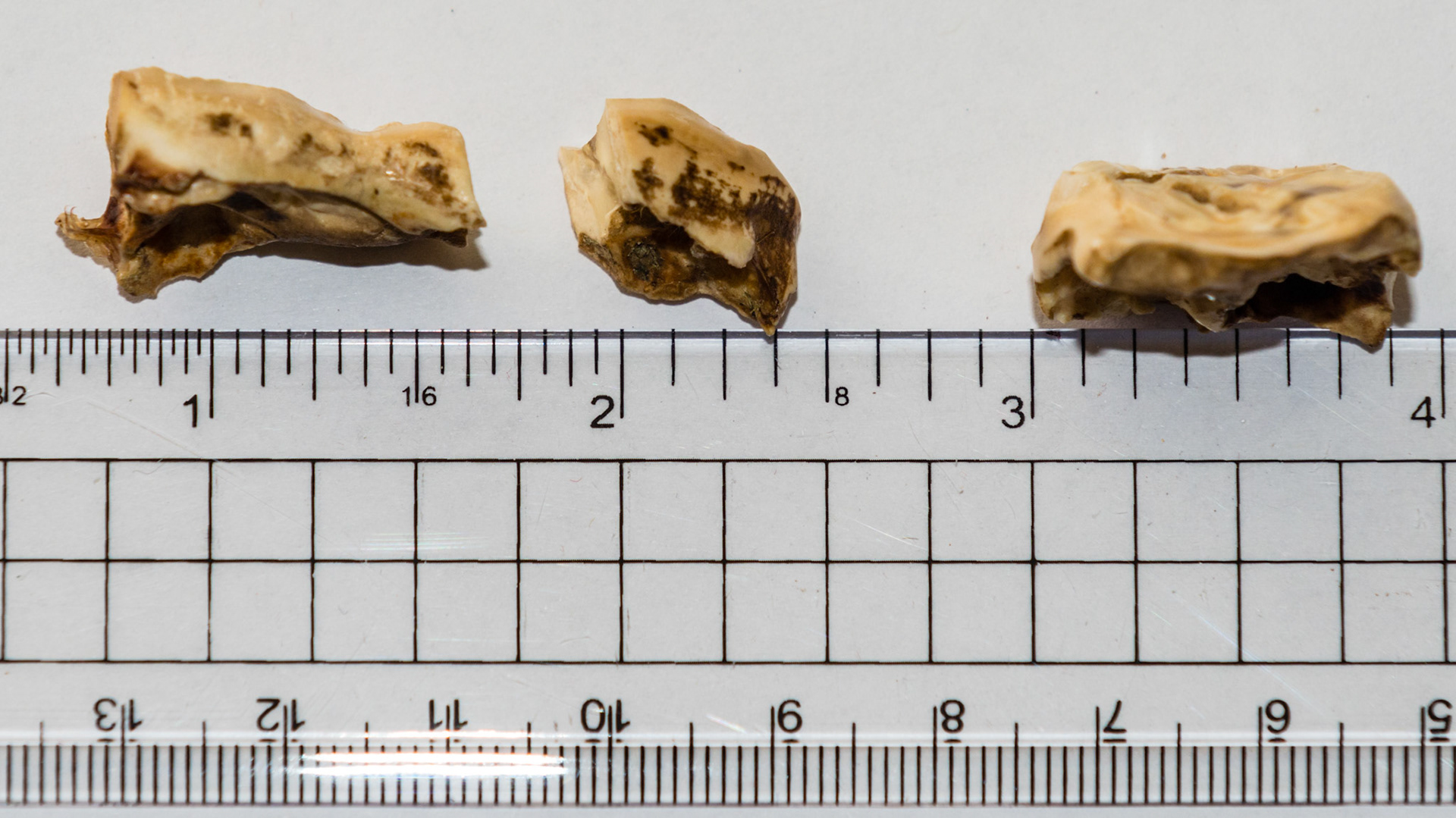 These are examples of broken cheek teeth caps. The broken edge can be very sharp causing discomfort in these horses.