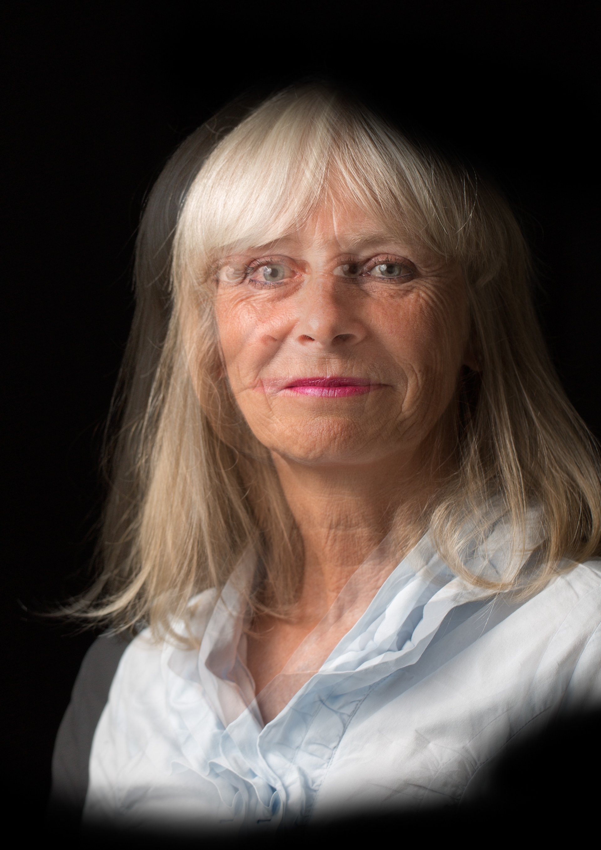 Glaucoom met Baerveldt implantaat