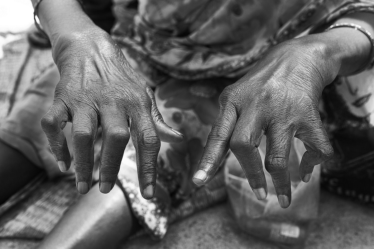 Suguna’s (Same as 7) fingers are crippled with arthritis and she has self confessed mental illness so she cannot seek work. She says she feels trapped and veers from lamentation to euphoria