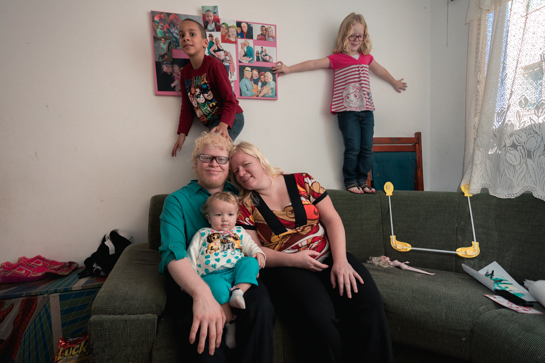 Família albina leva rotina comum em Osasco, na Grande São Paulo