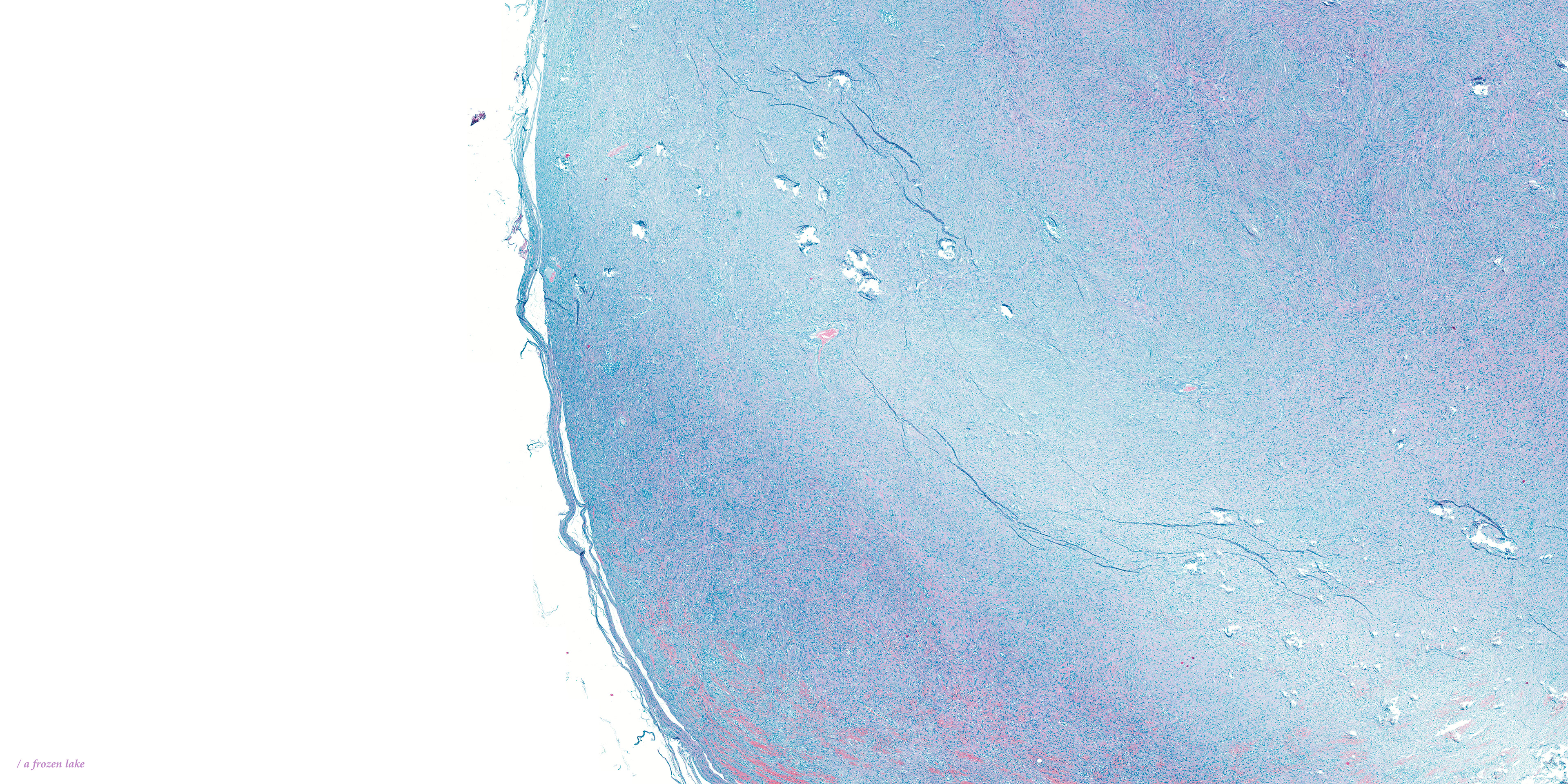 / a frozen lake