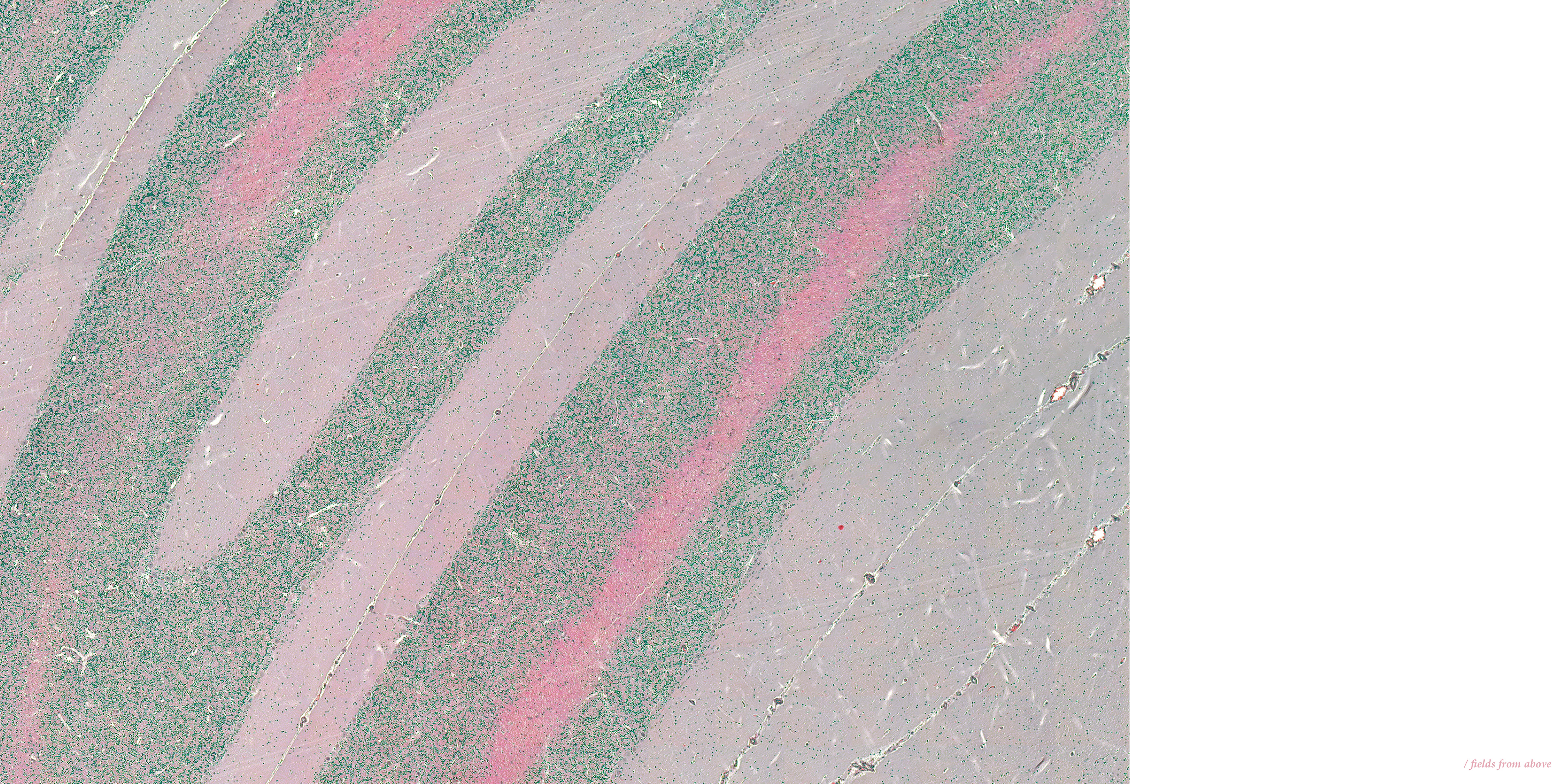 / fields from above