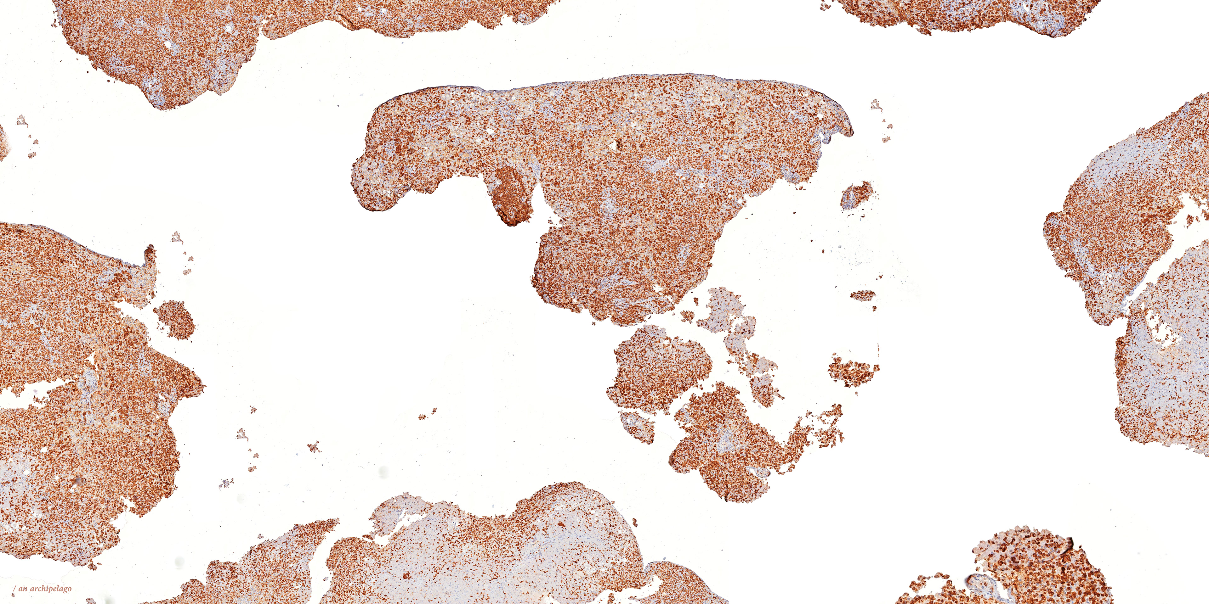 / an archipelago