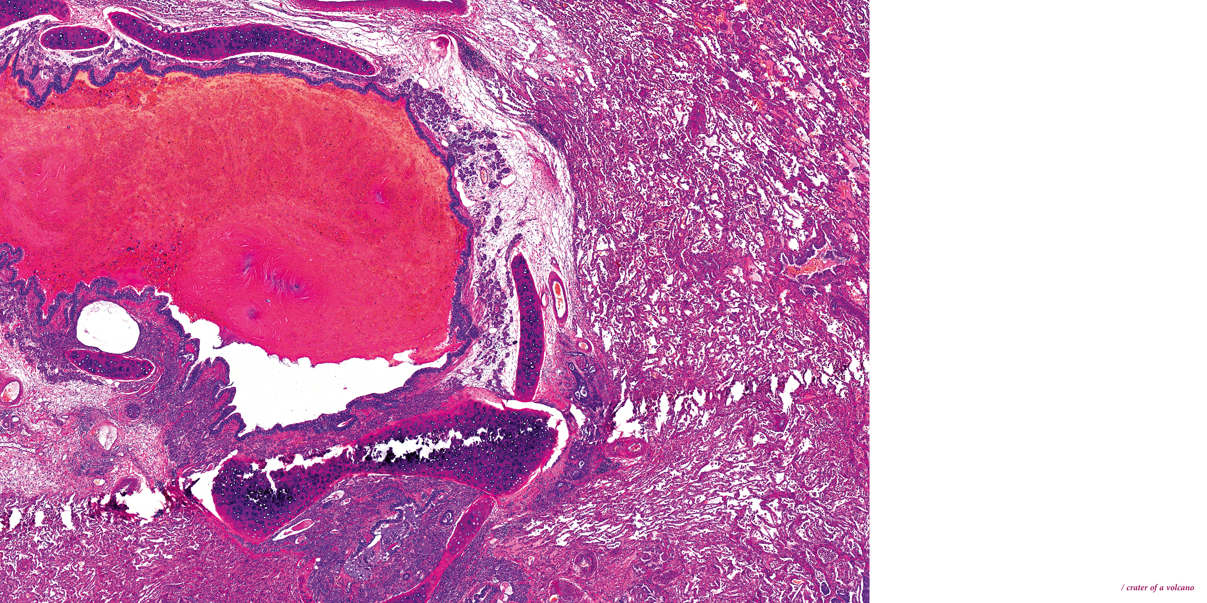/ crater of a volcano