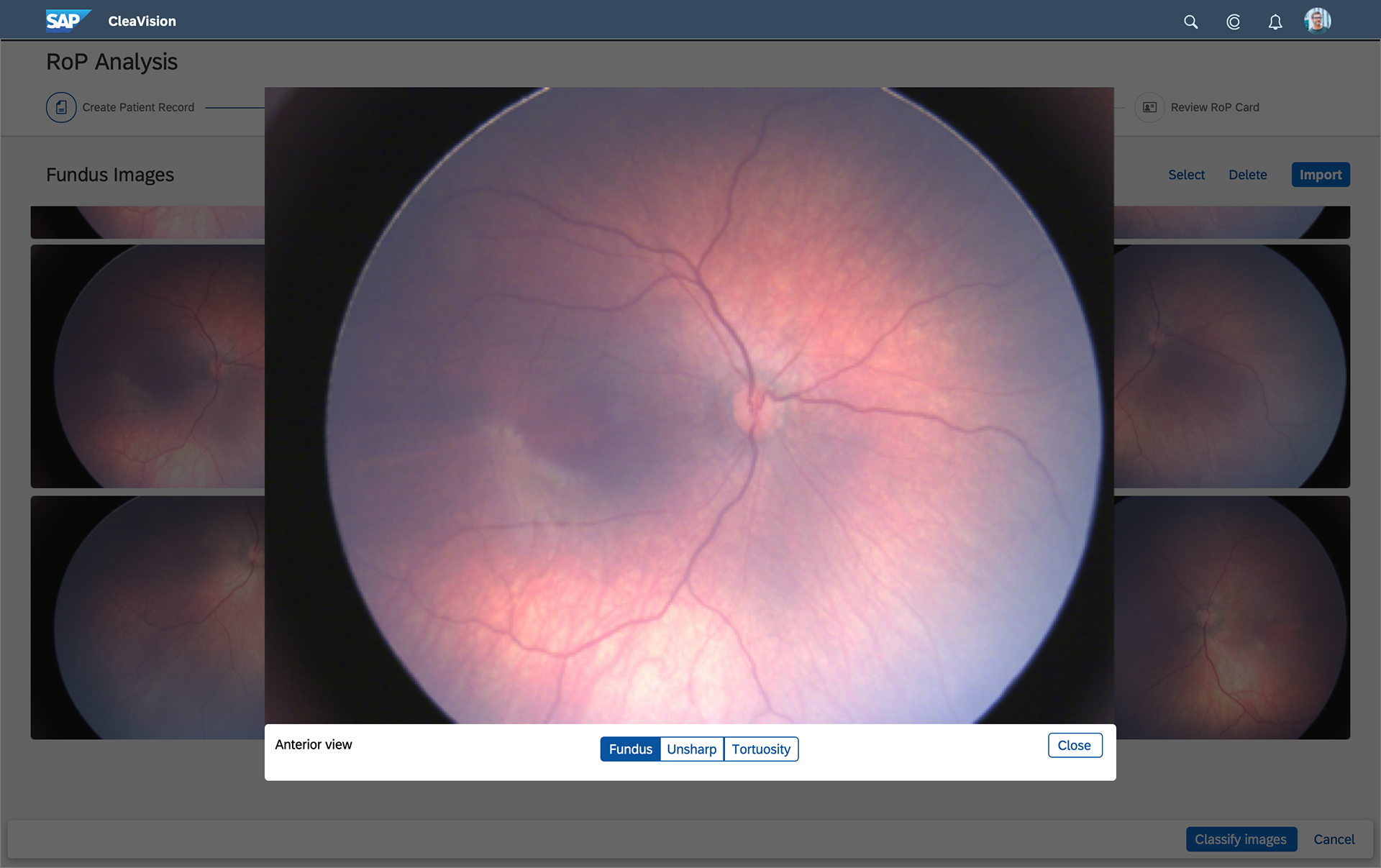 Fundus View