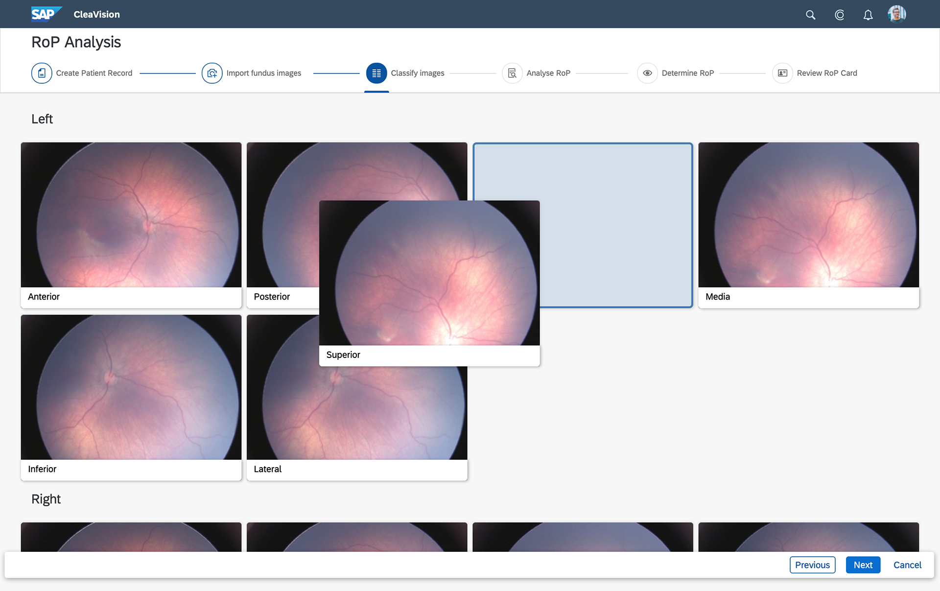 Image Classification